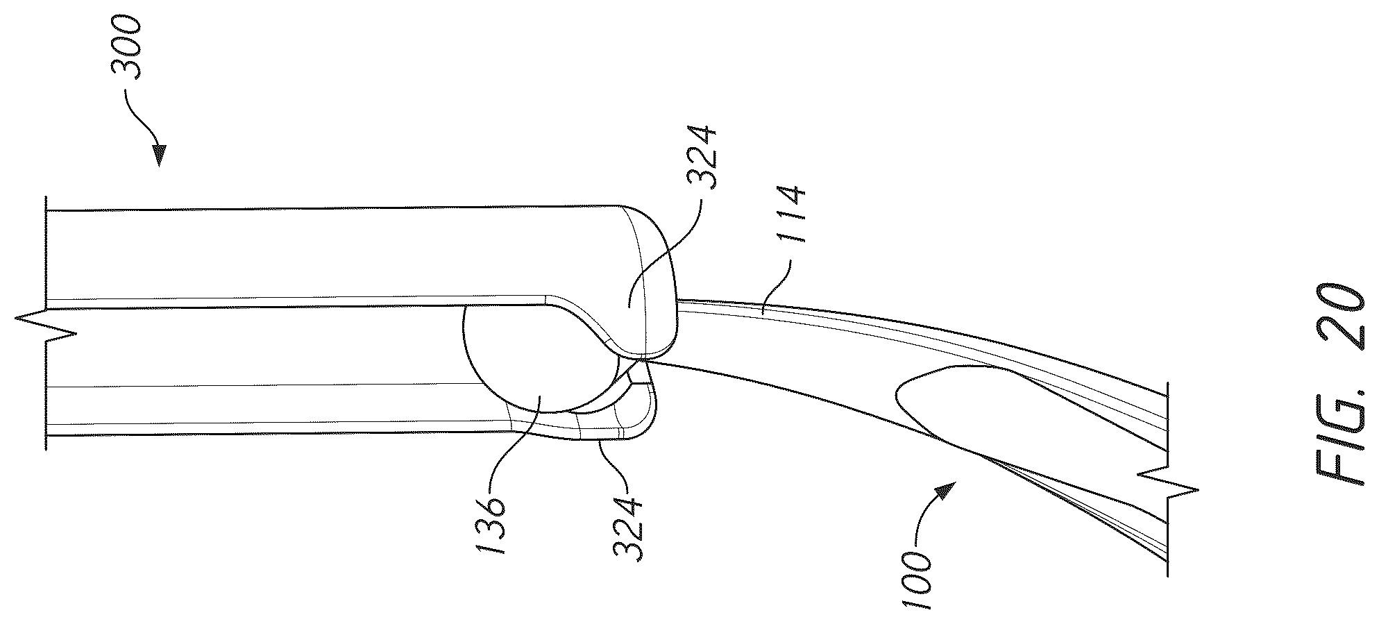 Patent US12569281 Figure 20 – Bone tie and bone tie inserter