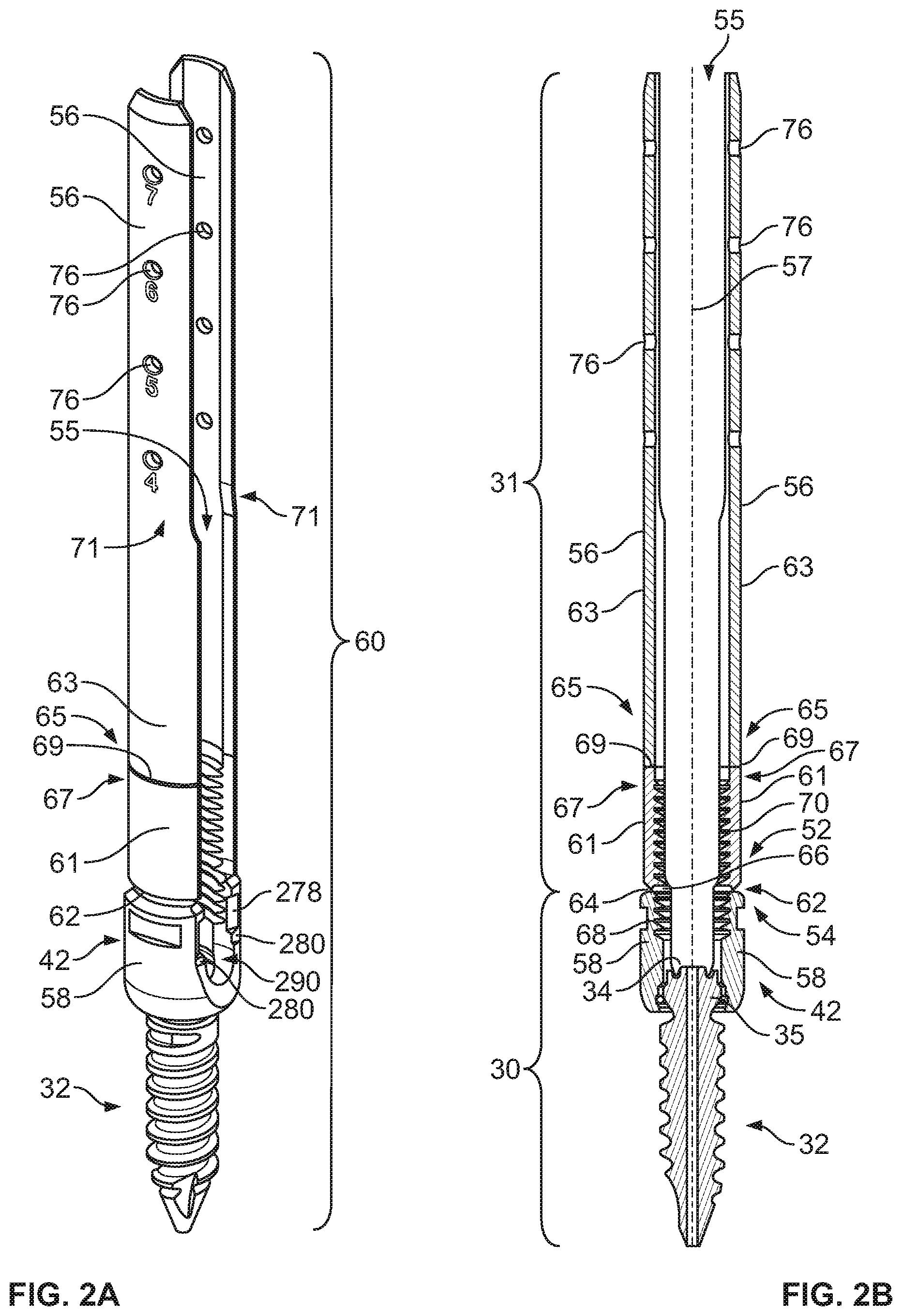 Patent US12569282 Figure 2 – Tissue retraction and vertebral displacement devices, systems, and methods for posterior spinal fusion