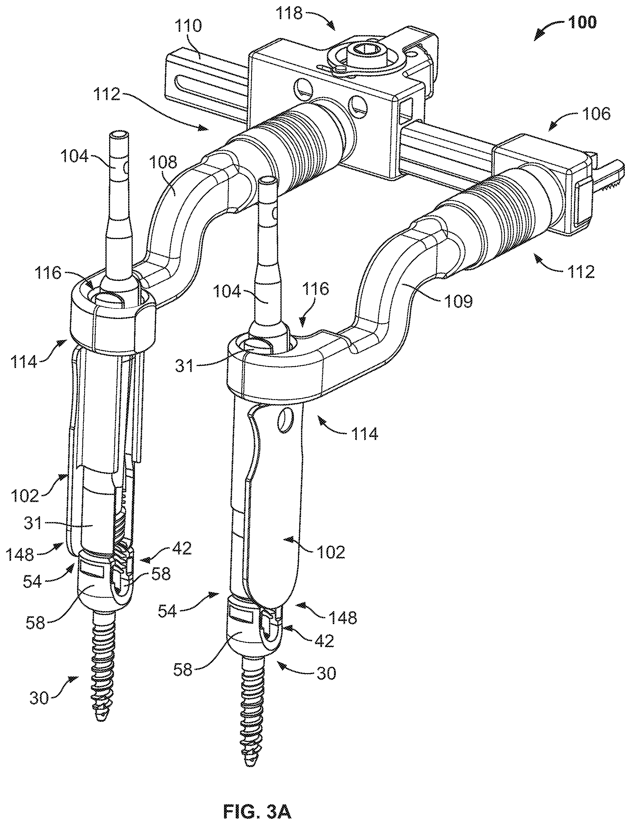 Patent US12569282 Figure 3 – Tissue retraction and vertebral displacement devices, systems, and methods for posterior spinal fusion