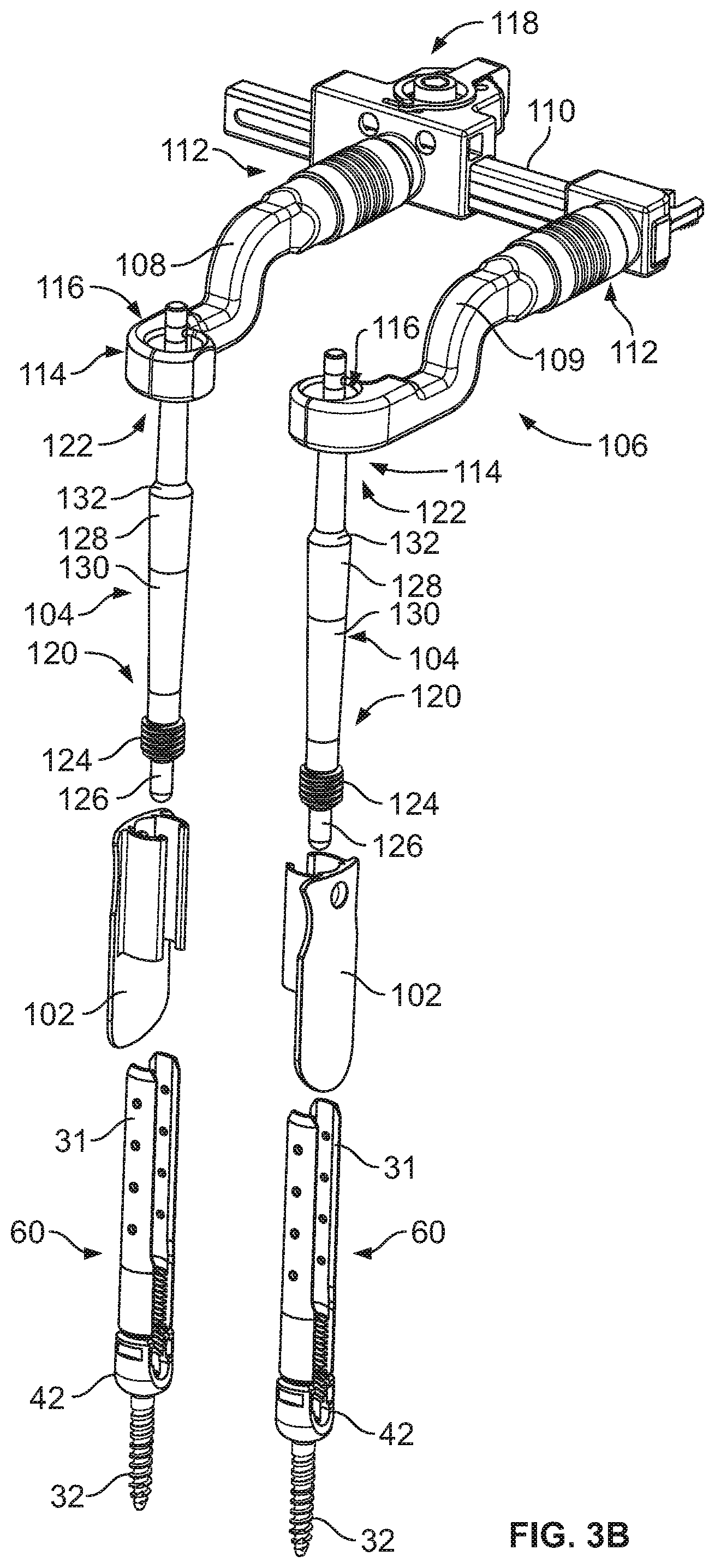 Patent US12569282 Figure 4 – Tissue retraction and vertebral displacement devices, systems, and methods for posterior spinal fusion