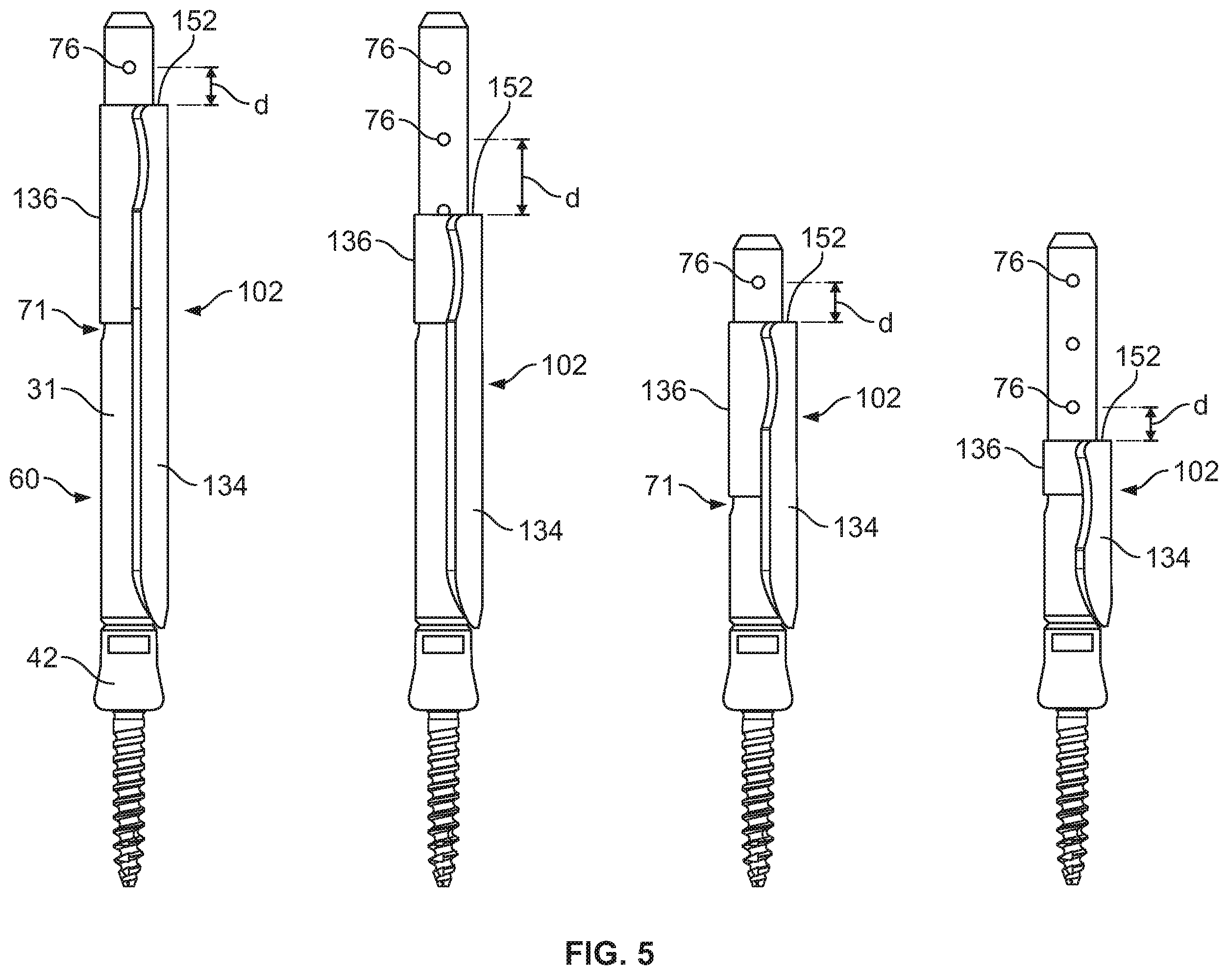 Patent US12569282 Figure 6 – Tissue retraction and vertebral displacement devices, systems, and methods for posterior spinal fusion