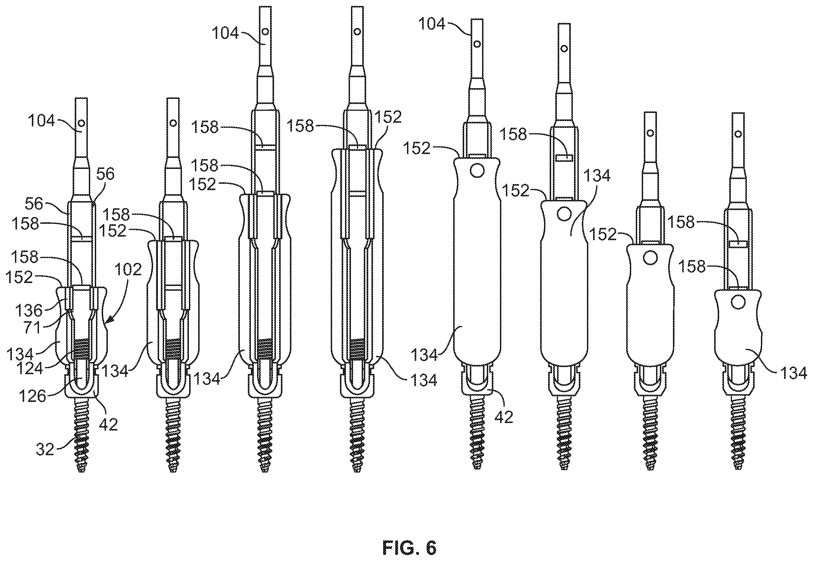 Patent US12569282 Figure 7 – Tissue retraction and vertebral displacement devices, systems, and methods for posterior spinal fusion