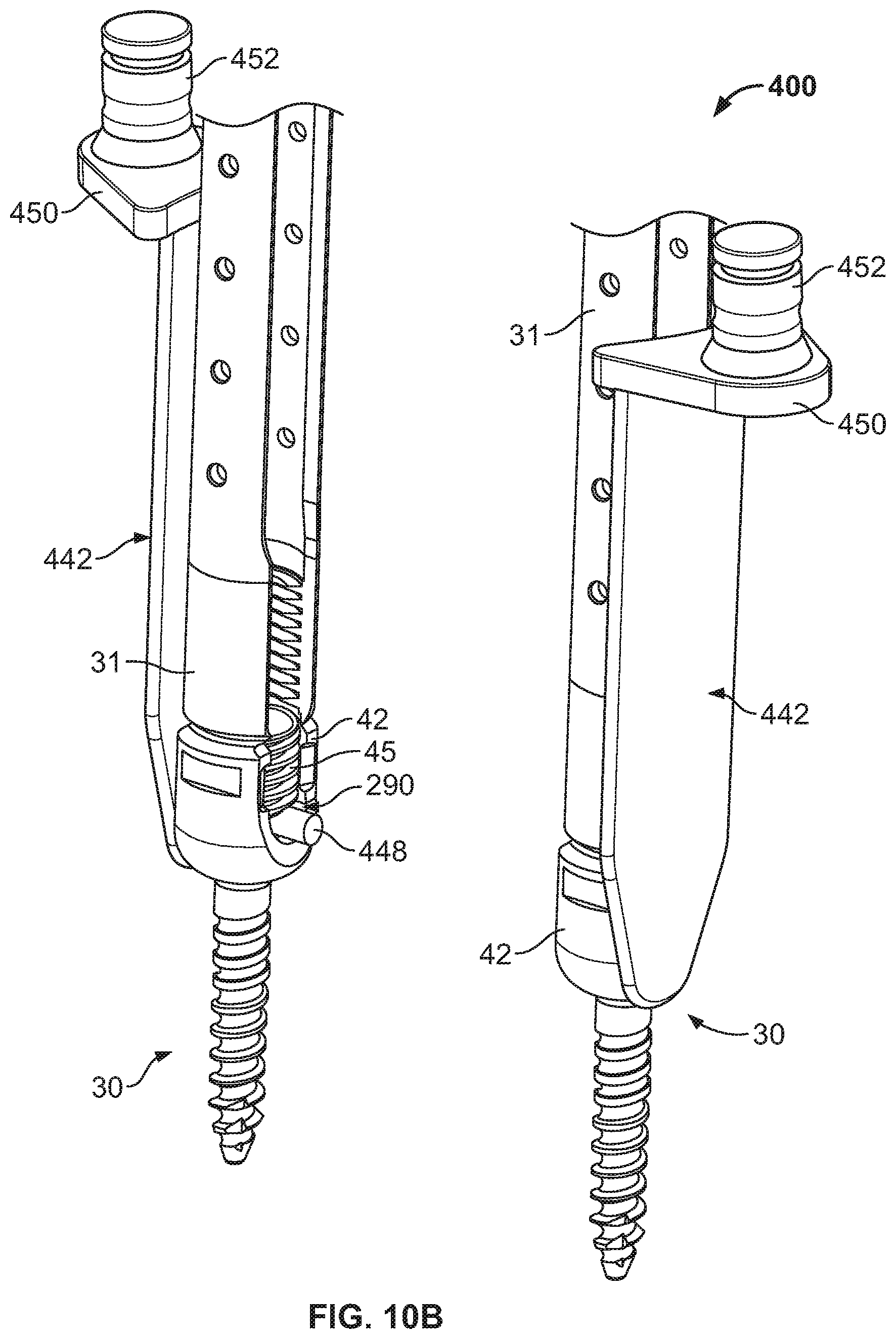 Patent US12569282 Figure 12 – Tissue retraction and vertebral displacement devices, systems, and methods for posterior spinal fusion