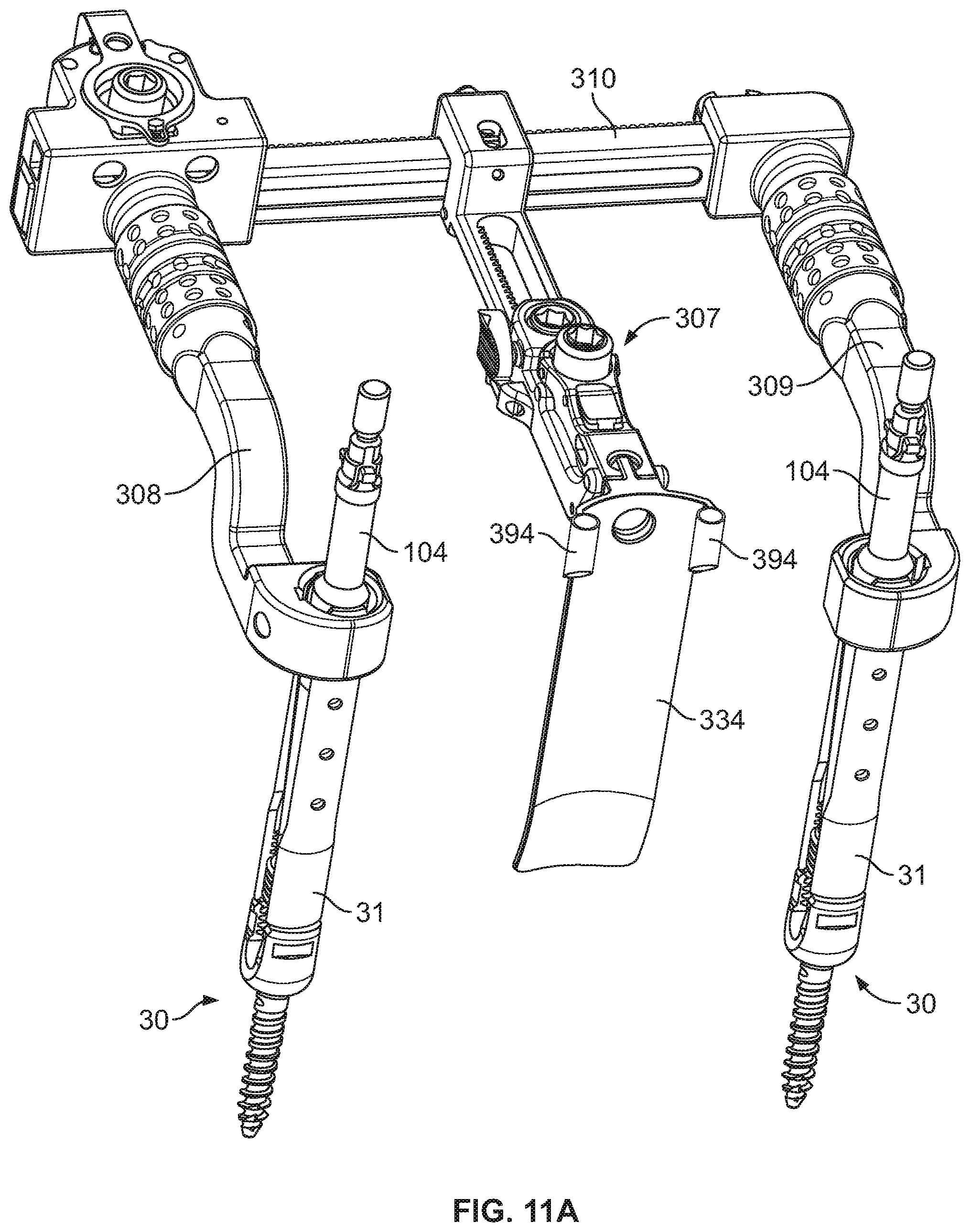 Patent US12569282 Figure 13 – Tissue retraction and vertebral displacement devices, systems, and methods for posterior spinal fusion