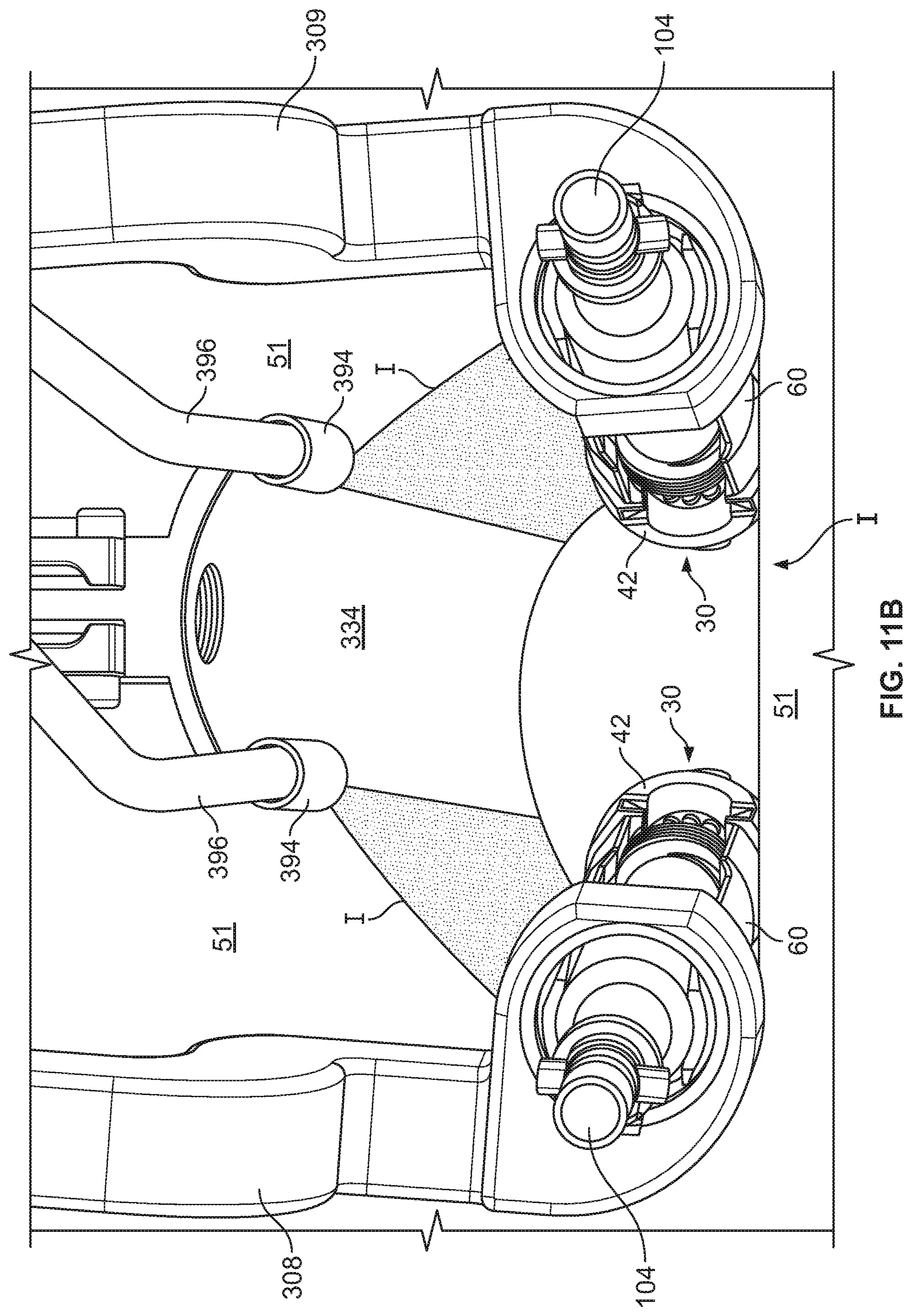 Patent US12569282 Figure 14 – Tissue retraction and vertebral displacement devices, systems, and methods for posterior spinal fusion
