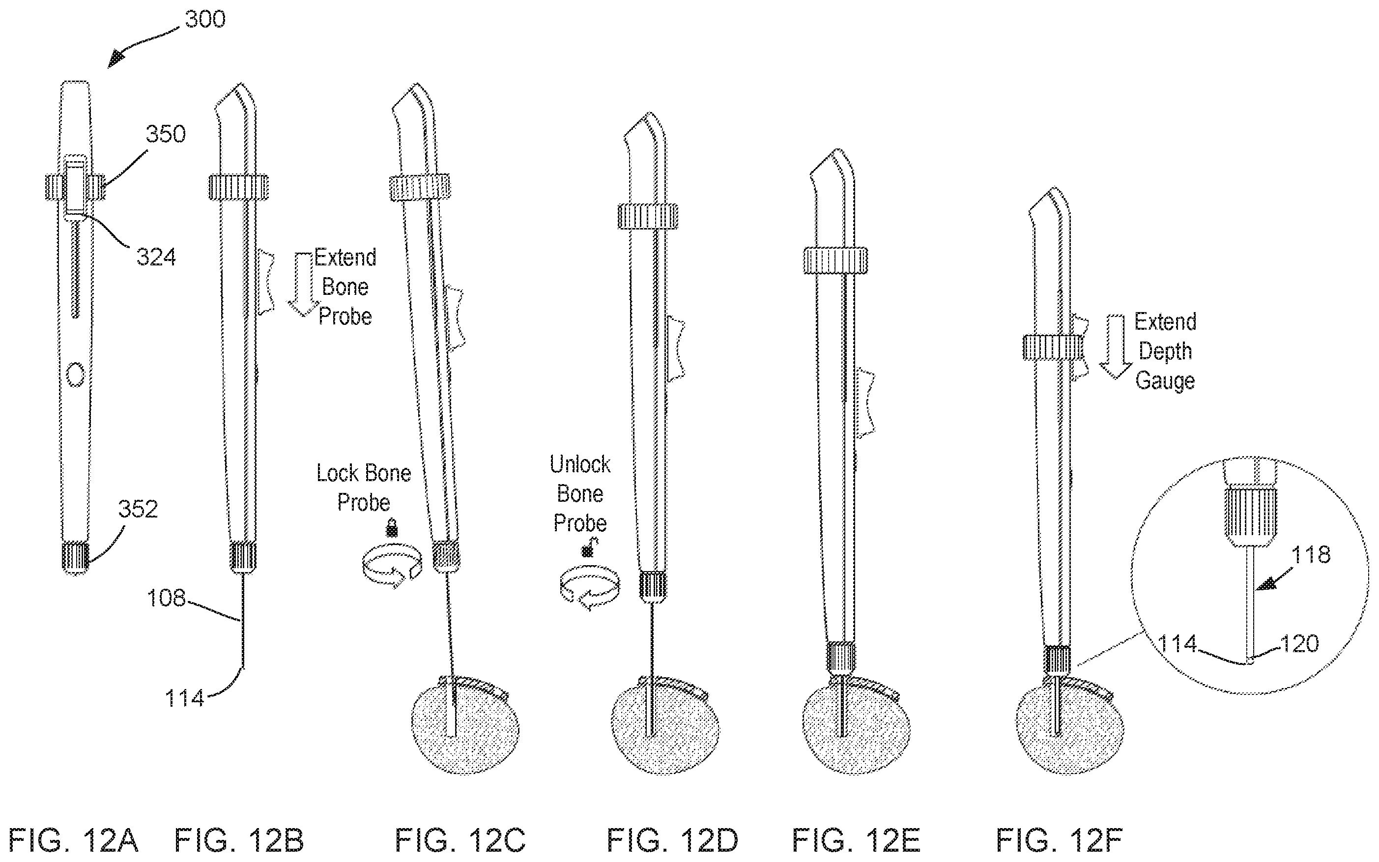 Patent US12569283 Figure 9 – Surgical depth instrument