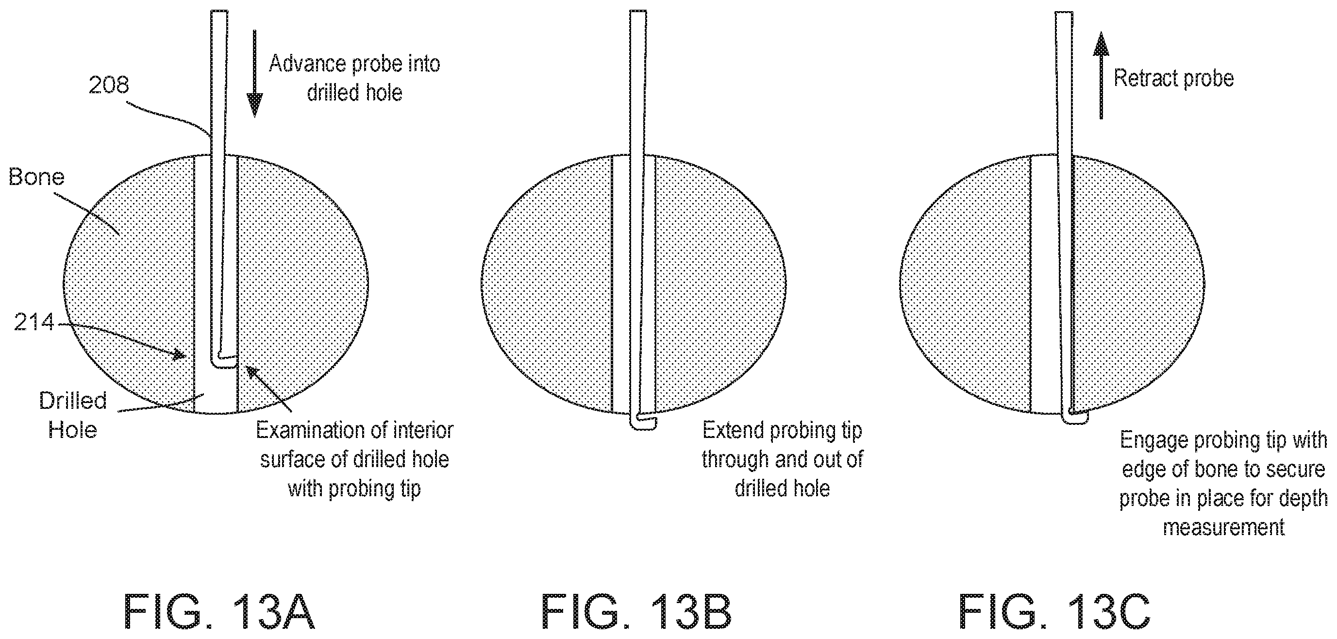Patent US12569283 Figure 10 – Surgical depth instrument