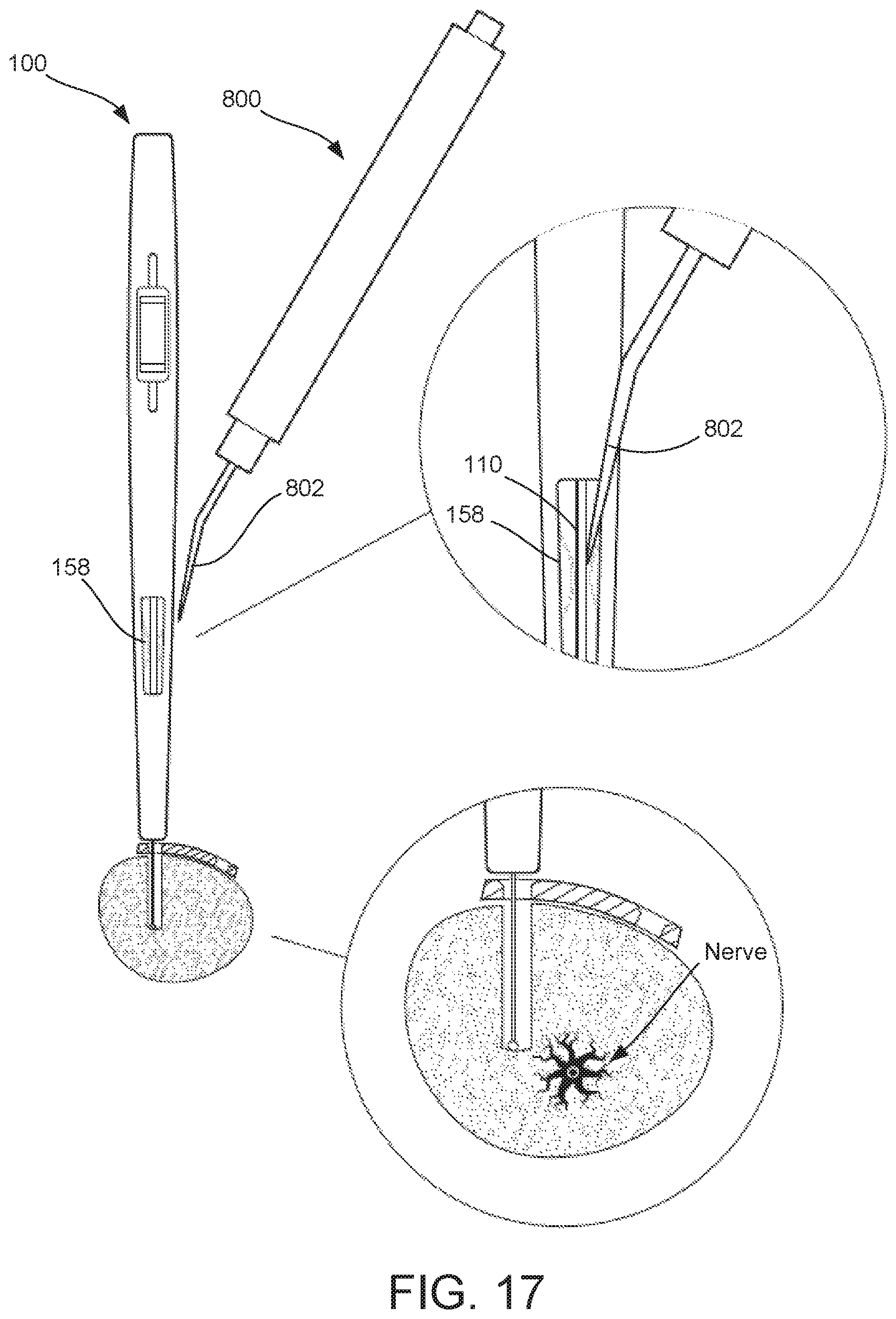 Patent US12569283 Figure 14 – Surgical depth instrument