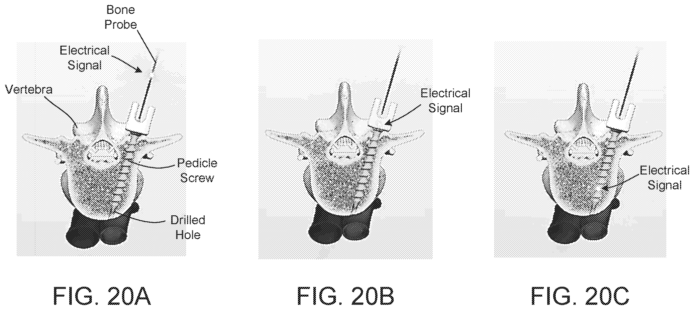 Patent US12569283 Figure 16 – Surgical depth instrument