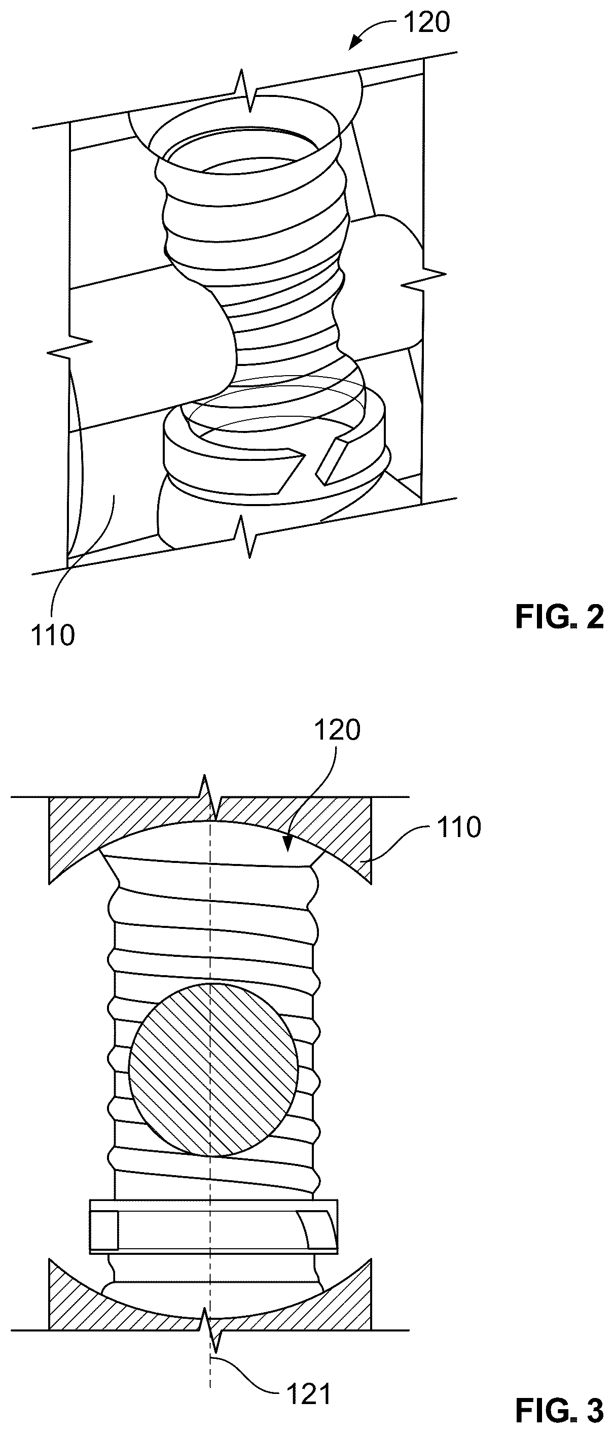 Patent US12569284 Figure 2 – Screw hole adapted for different screws