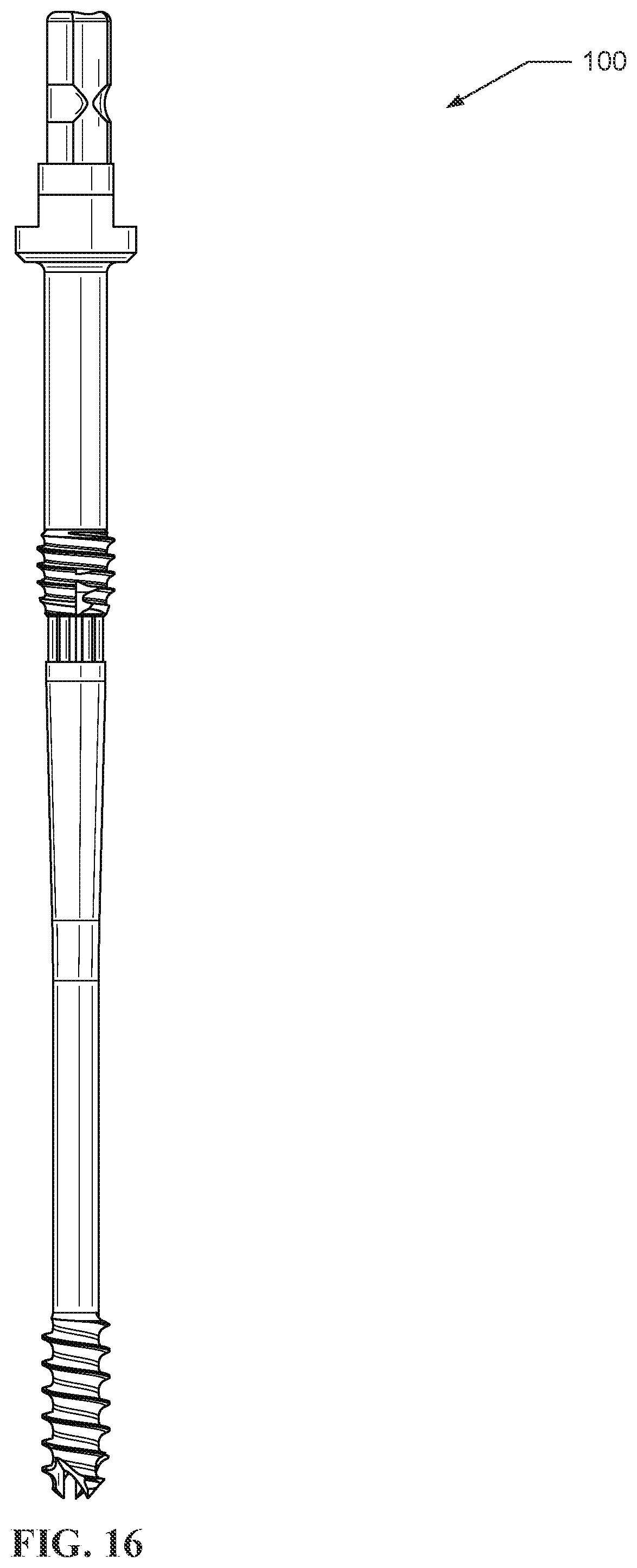 Patent US12569285 Figure 16 – Dynamic compression devices and processes for making and using same