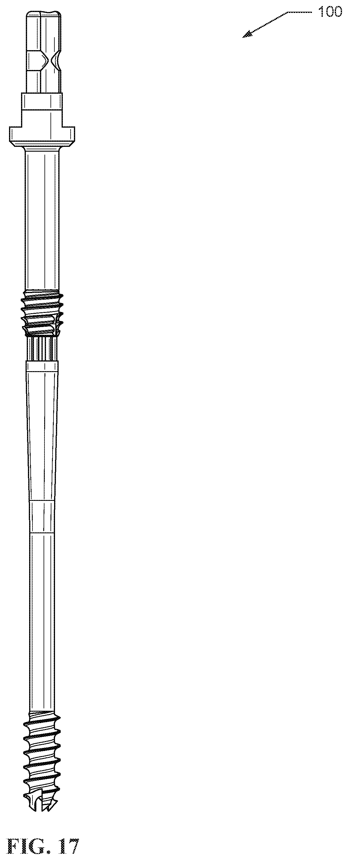 Patent US12569285 Figure 17 – Dynamic compression devices and processes for making and using same