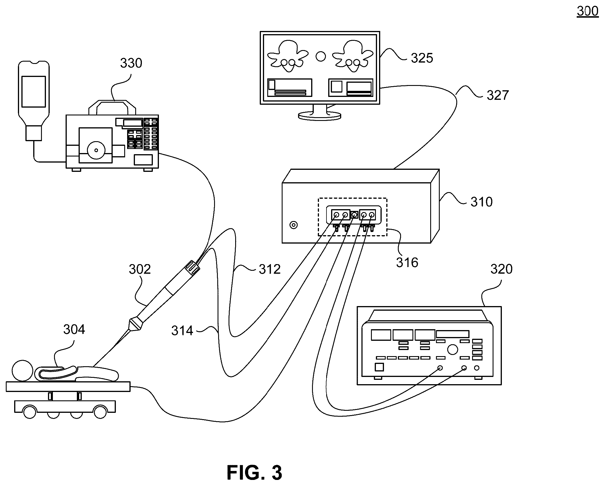 Patent US12569286 Figure 3 – Accuracy of ablation model through synchronization