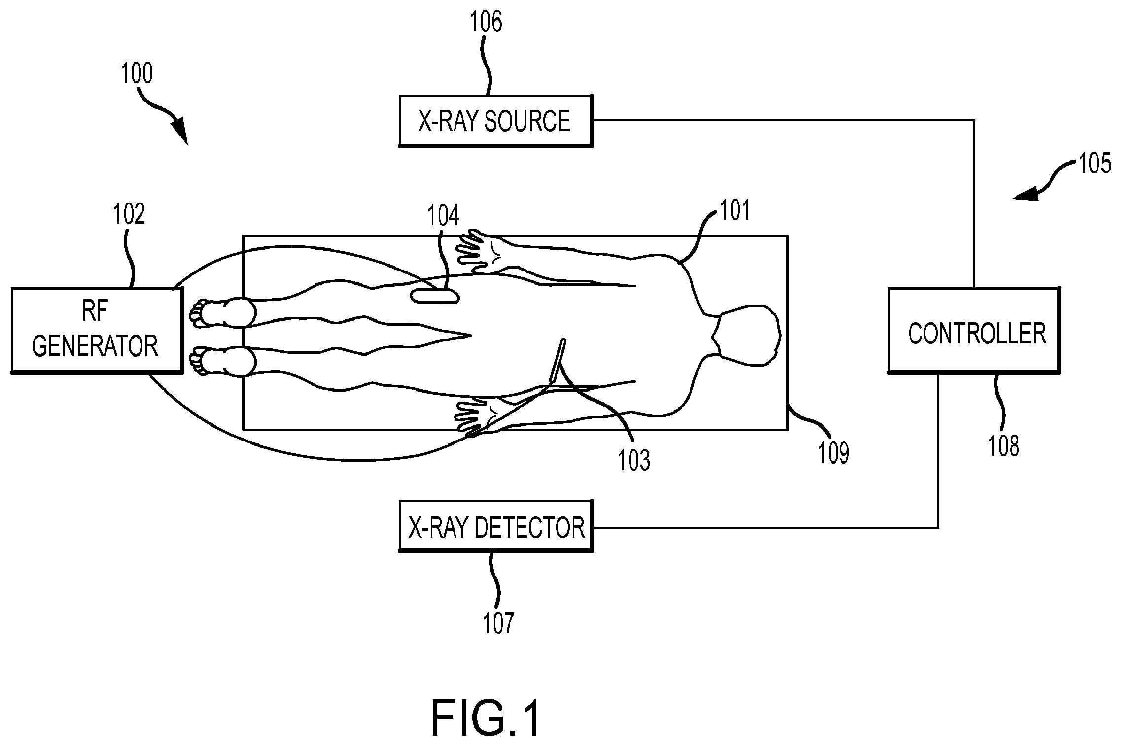 Patent US12569293 Figure 1 – Systems for radiofrequency neurotomy
