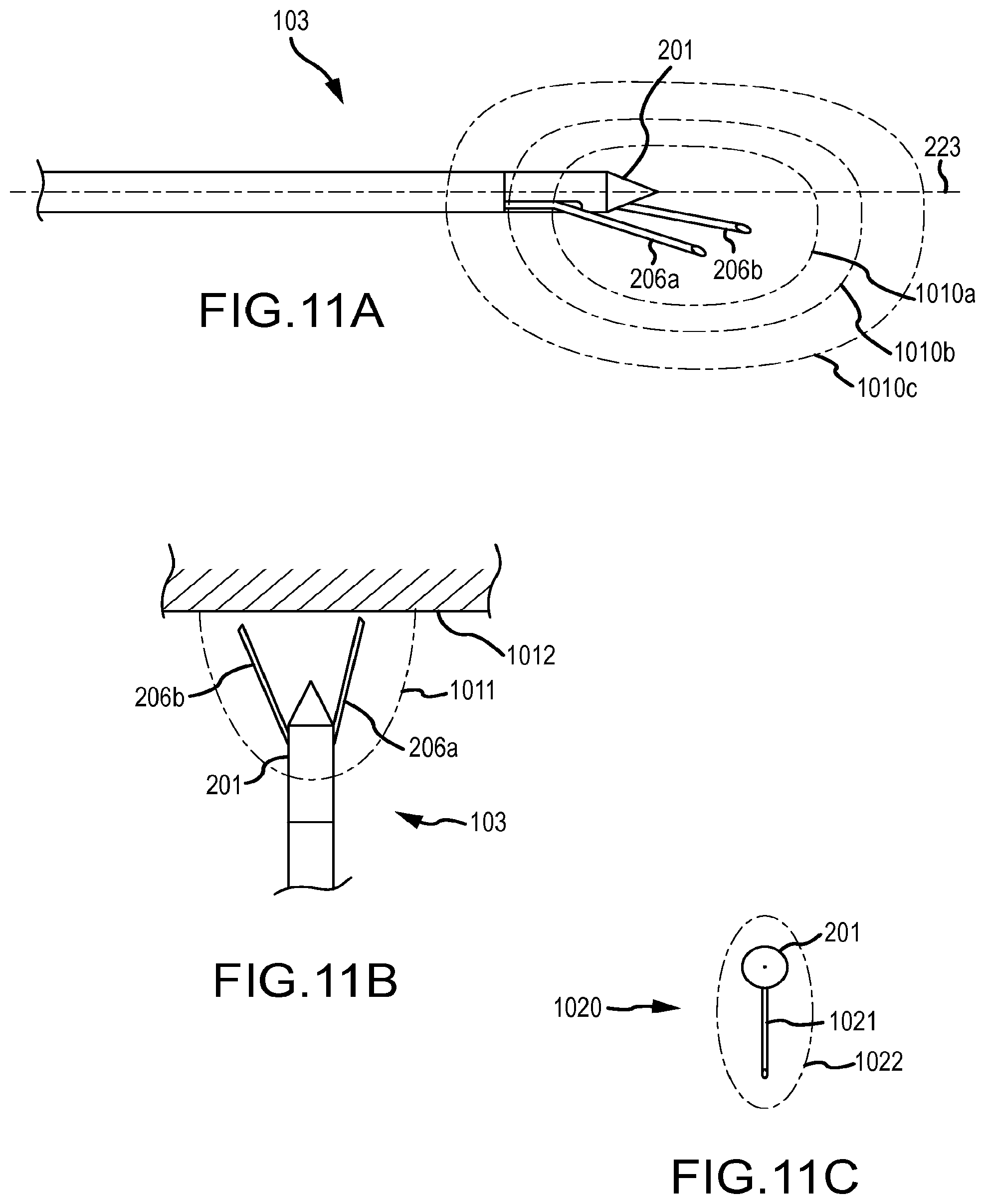 Patent US12569293 Figure 15 – Systems for radiofrequency neurotomy