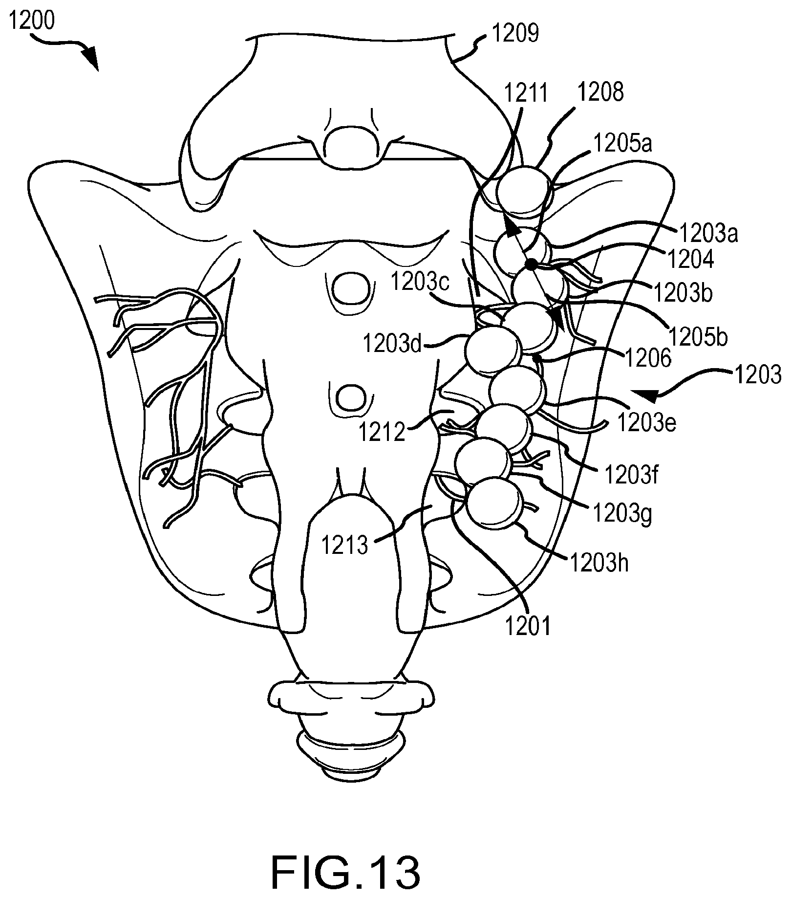 Patent US12569293 Figure 17 – Systems for radiofrequency neurotomy