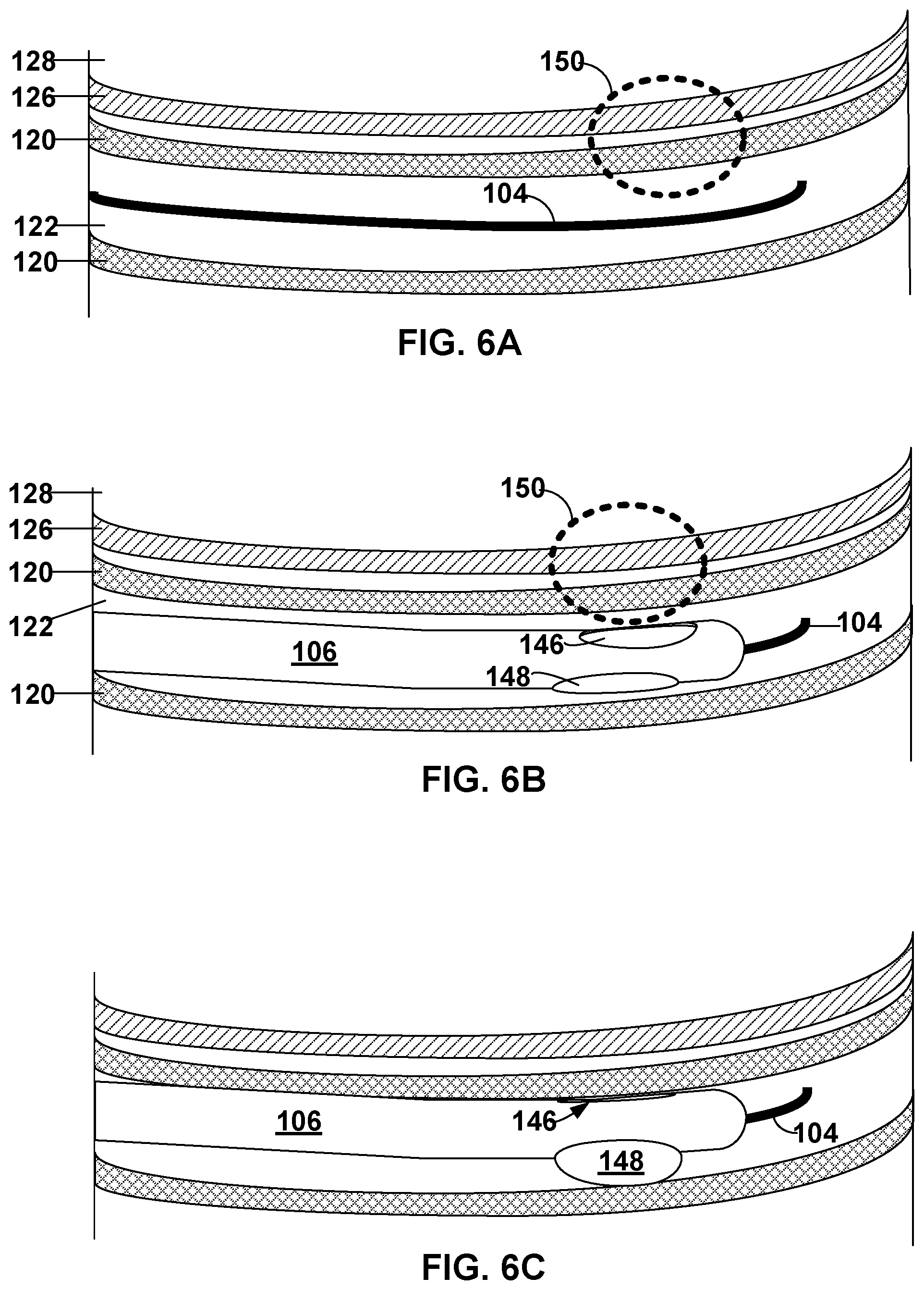 Patent US12569296 Figure 6 – Left-atrium-to-coronary-sinus shunt