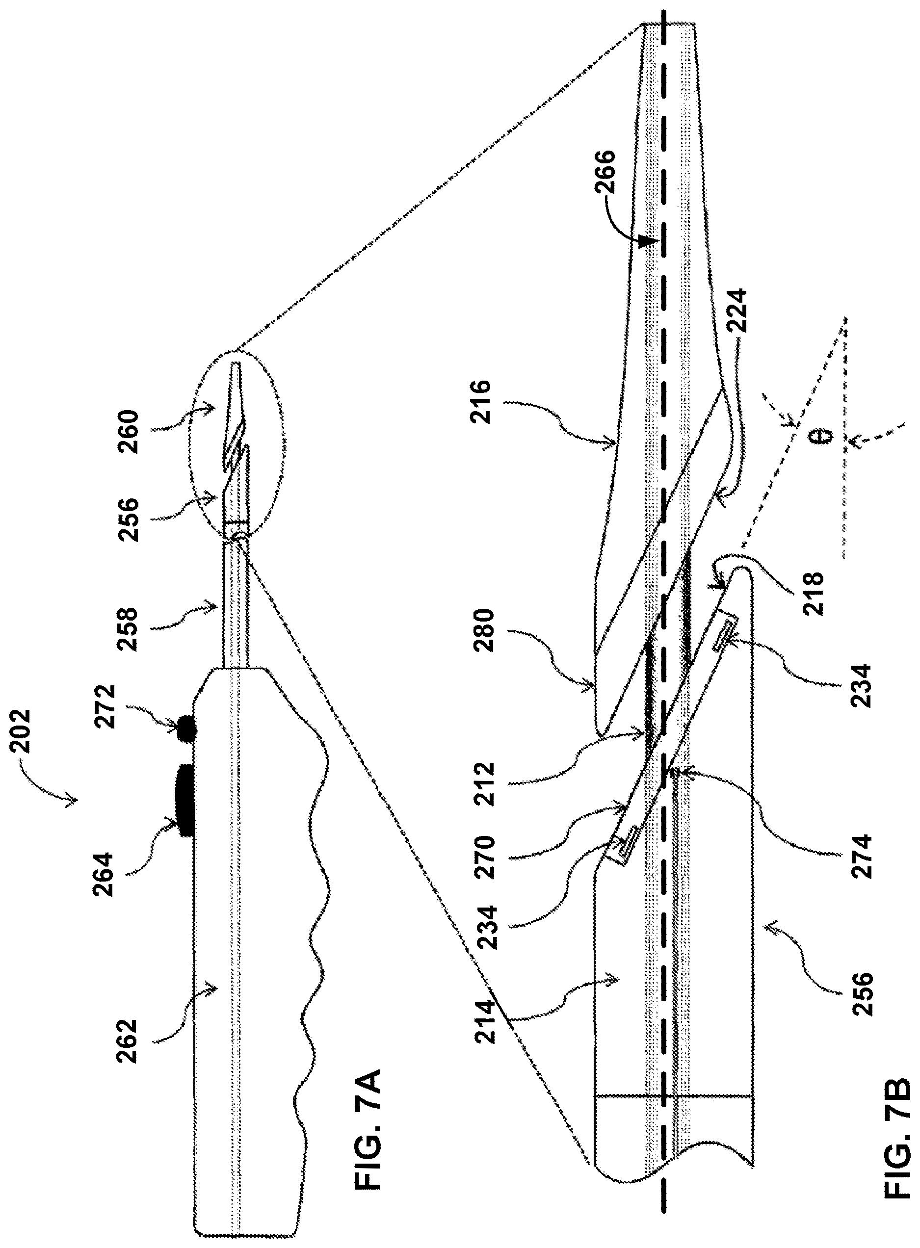 Patent US12569296 Figure 11 – Left-atrium-to-coronary-sinus shunt