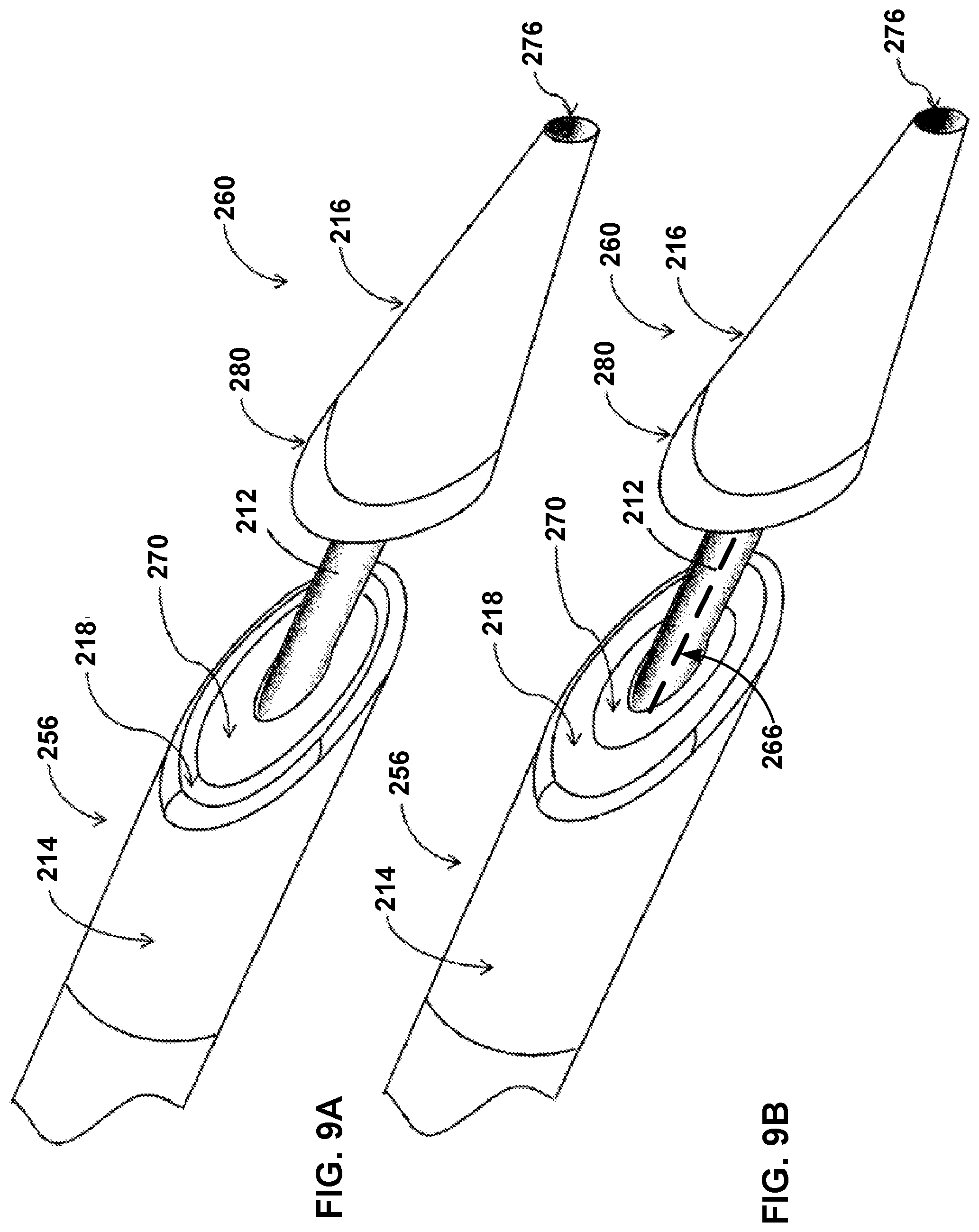 Patent US12569296 Figure 13 – Left-atrium-to-coronary-sinus shunt