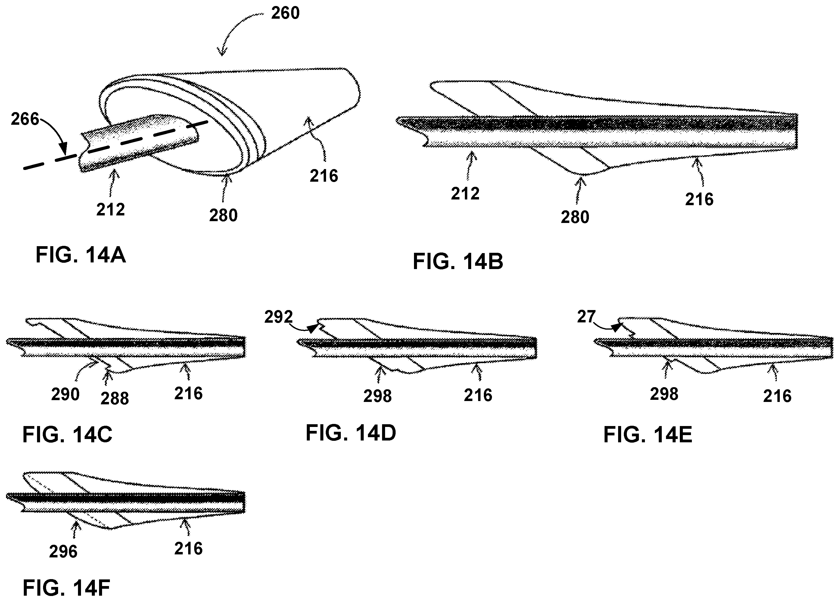 Patent US12569296 Figure 20 – Left-atrium-to-coronary-sinus shunt