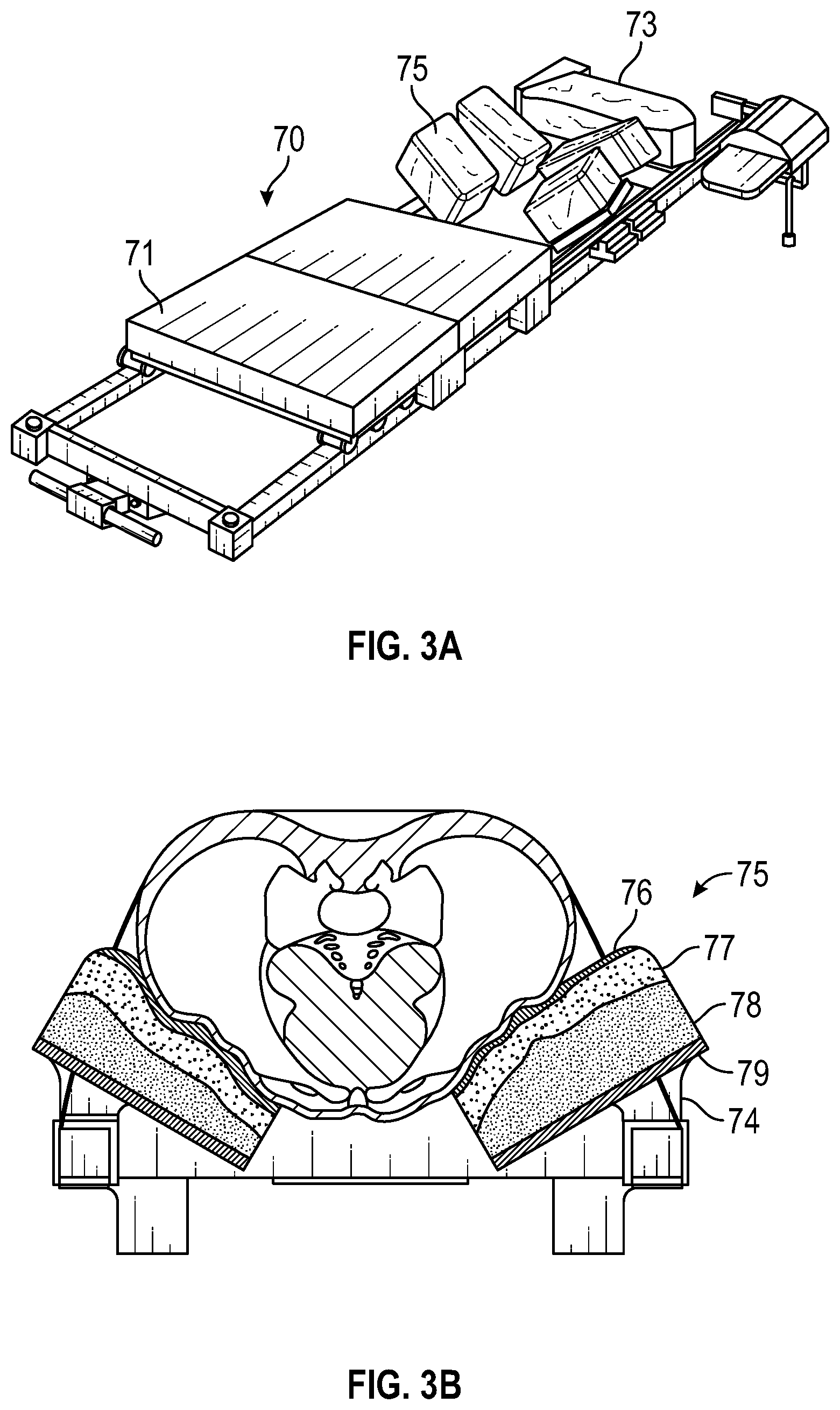 Patent US12569301 Figure 4 – Surgical navigation system for alignment of a surgical instrument