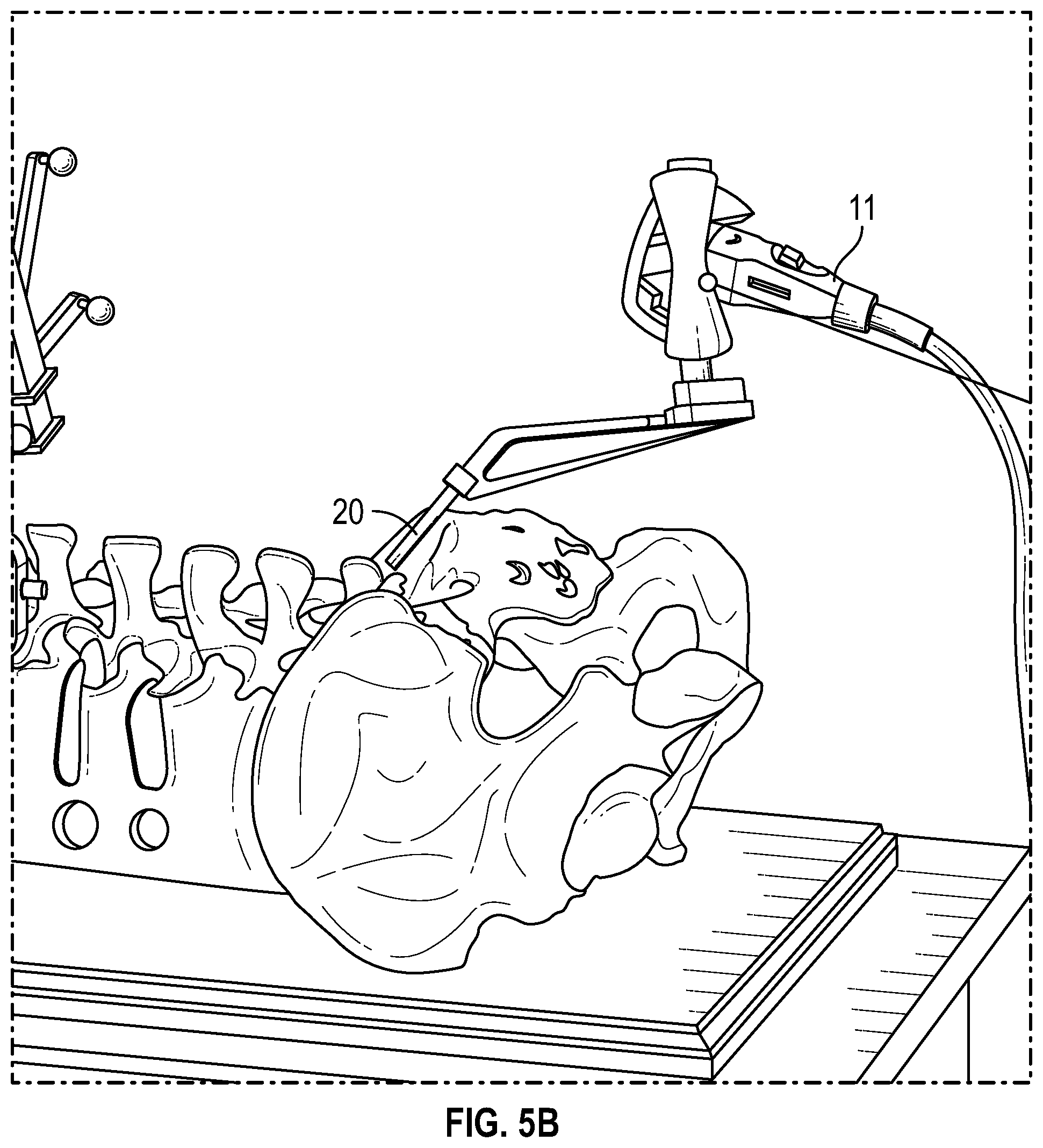 Patent US12569301 Figure 7 – Surgical navigation system for alignment of a surgical instrument