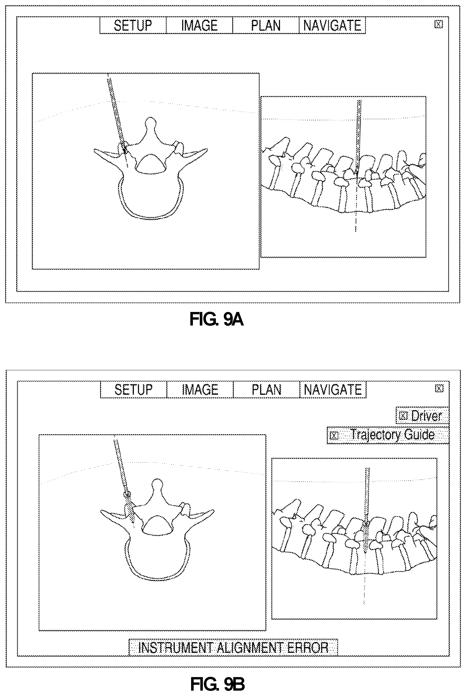 Patent US12569301 Figure 12 – Surgical navigation system for alignment of a surgical instrument