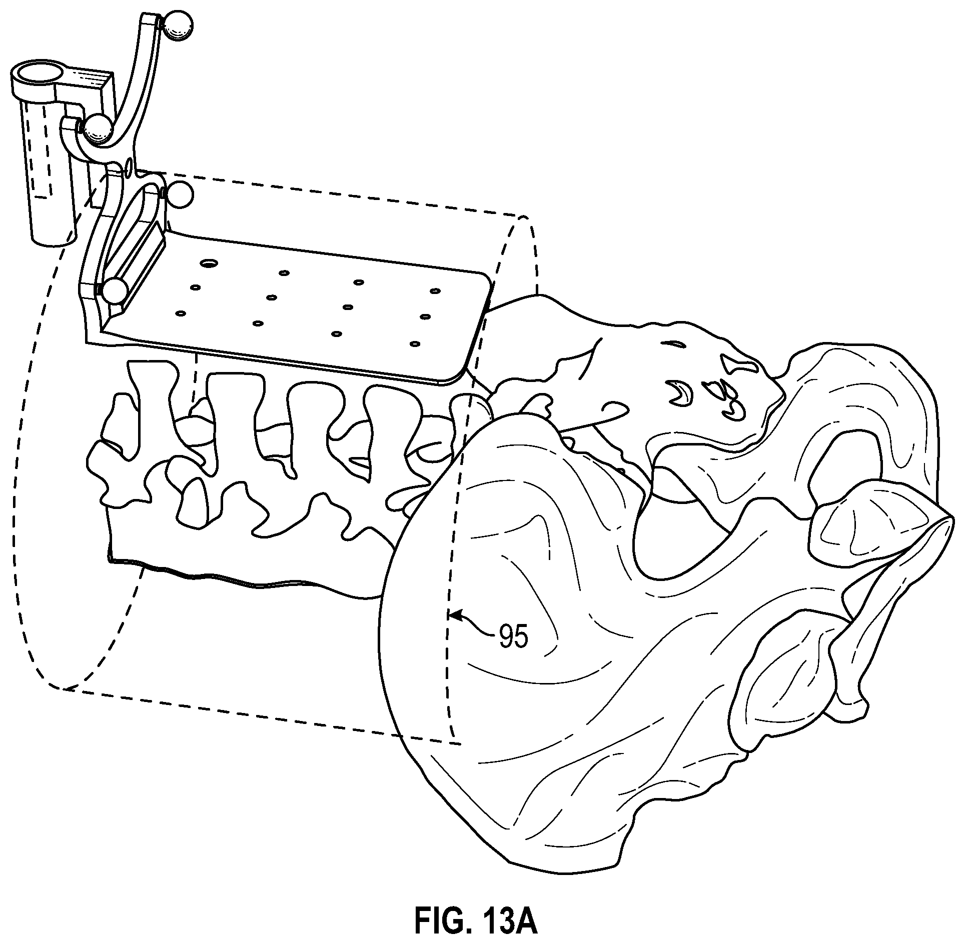 Patent US12569301 Figure 15 – Surgical navigation system for alignment of a surgical instrument