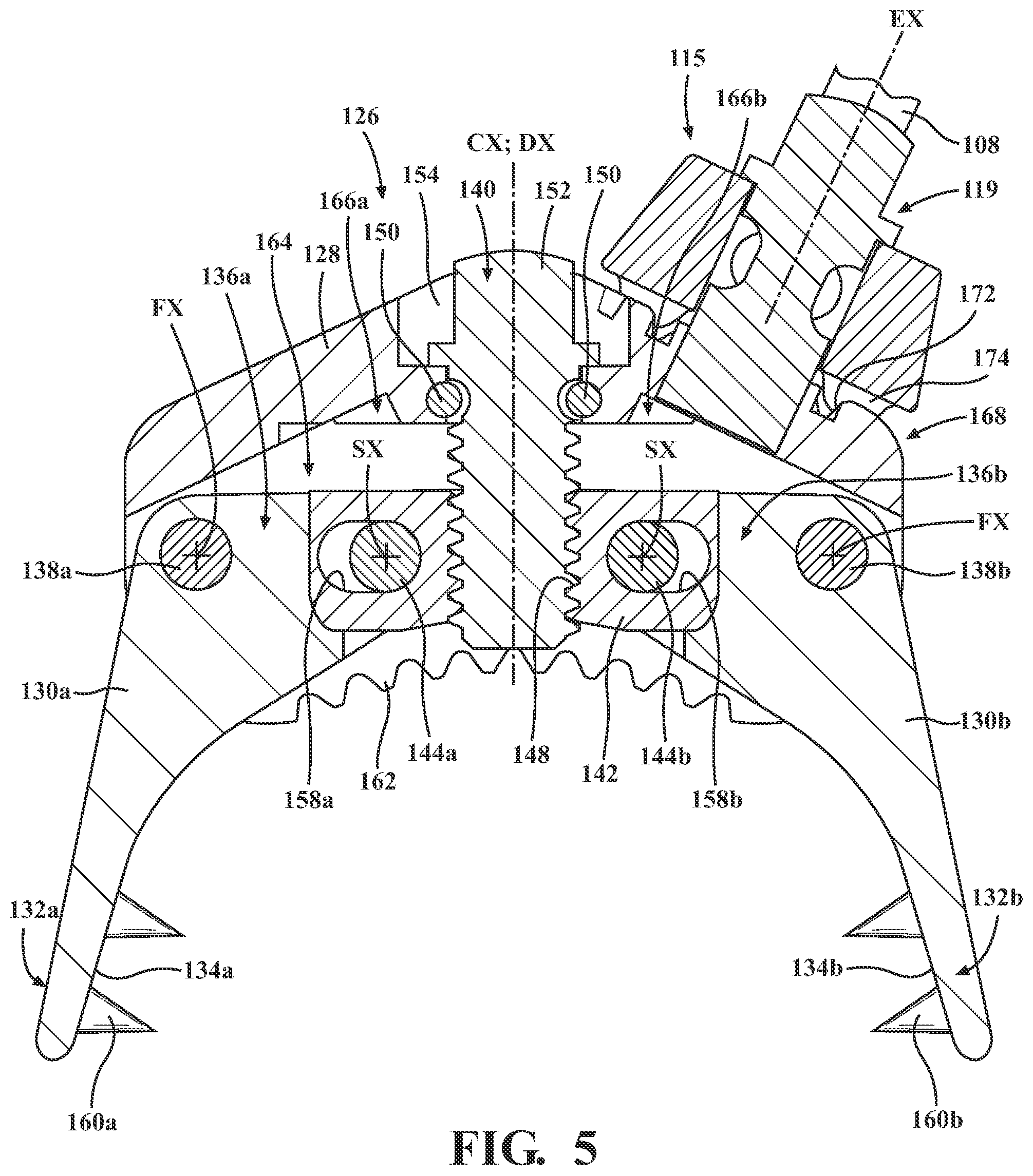 Patent US12569302 Figure 4 – Surgical clamp assembly for fixing a navigation tracker to a portion of bone