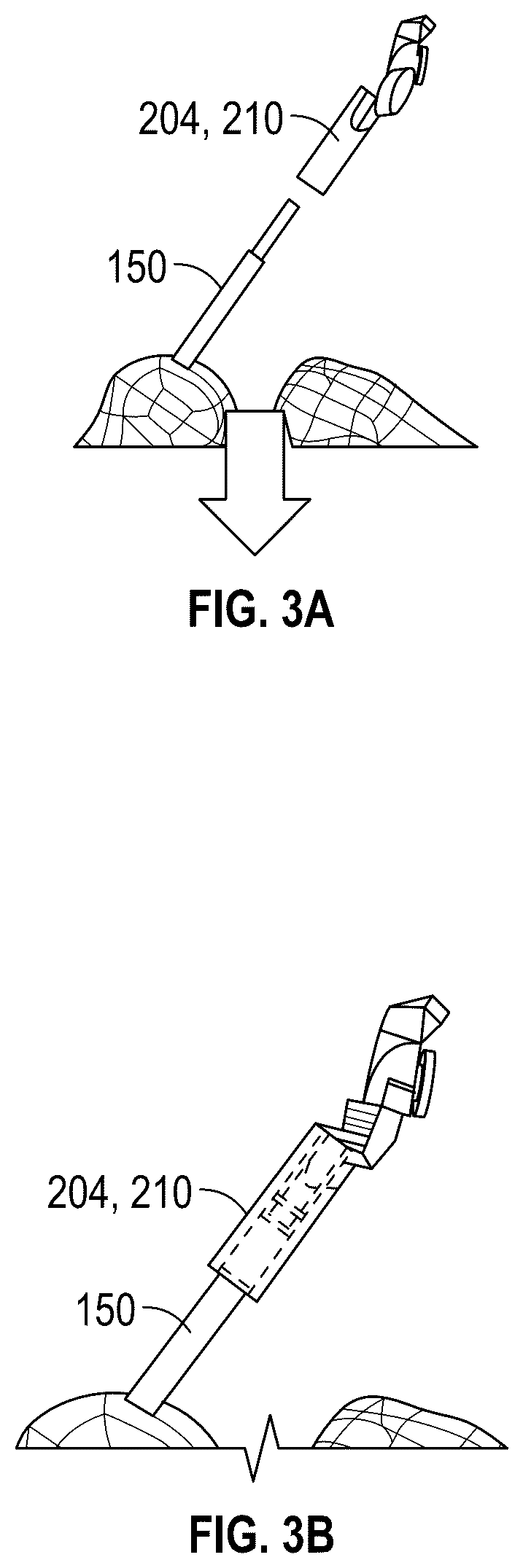Patent US12569306 Figure 3 – Robotic revision knee arthroplasty virtual reconstruction system