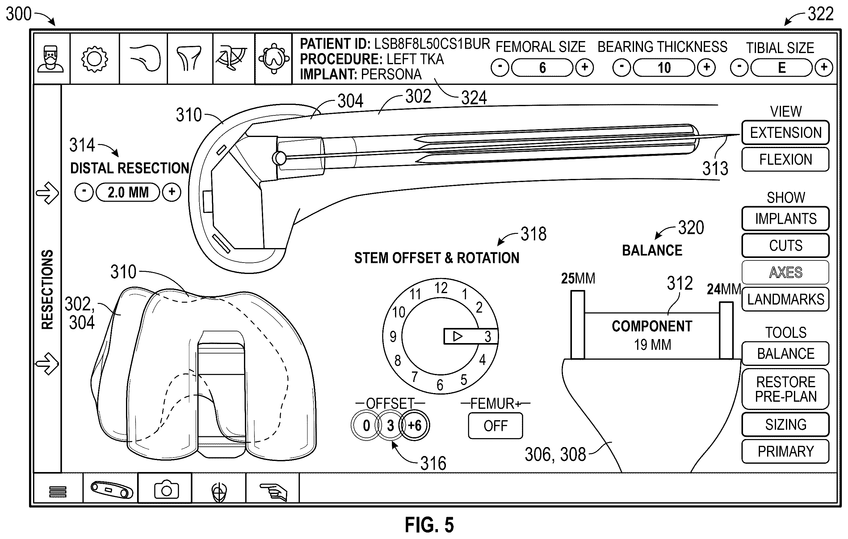 Patent US12569306 Figure 5 – Robotic revision knee arthroplasty virtual reconstruction system