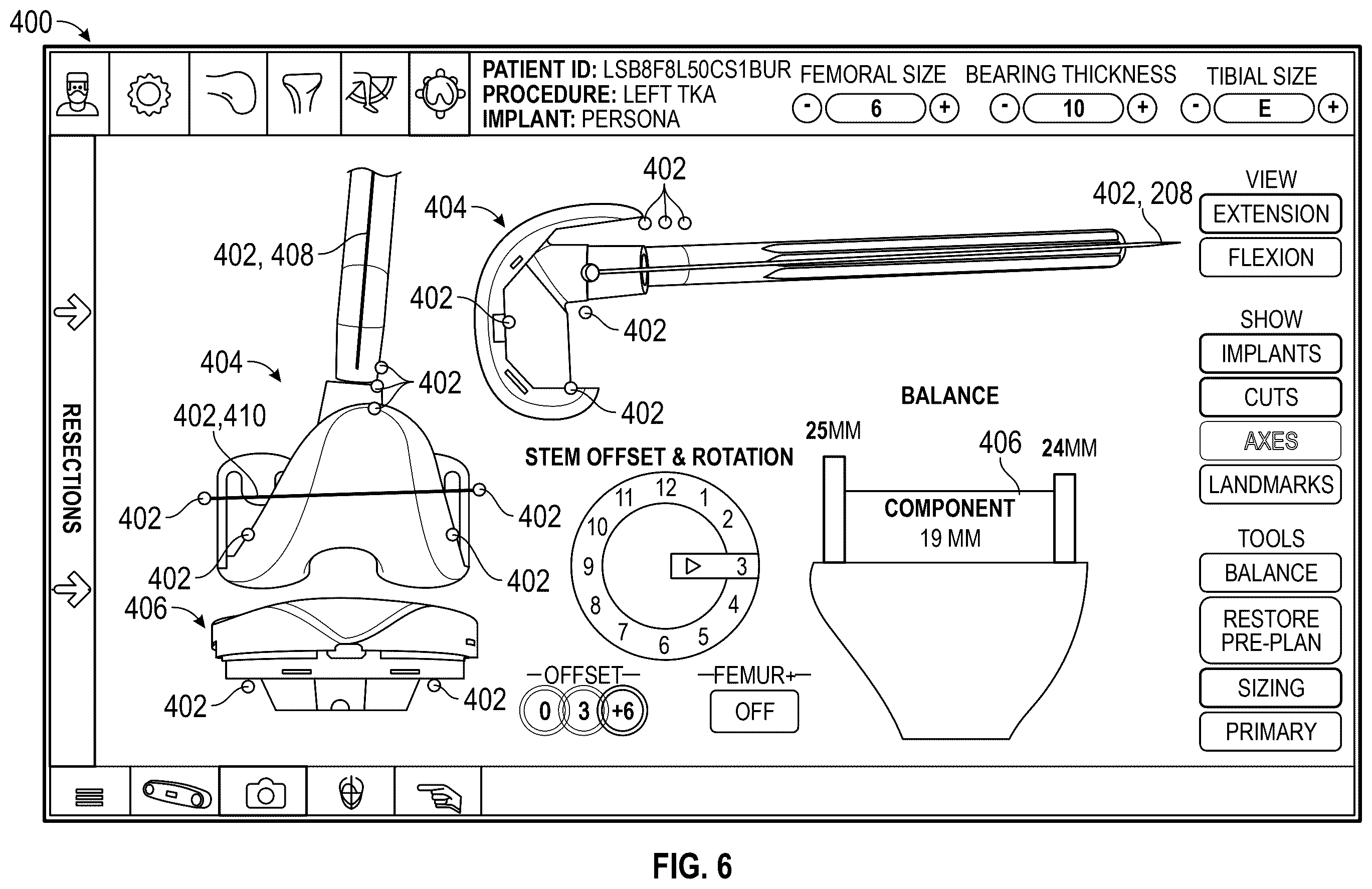 Patent US12569306 Figure 7 – Robotic revision knee arthroplasty virtual reconstruction system