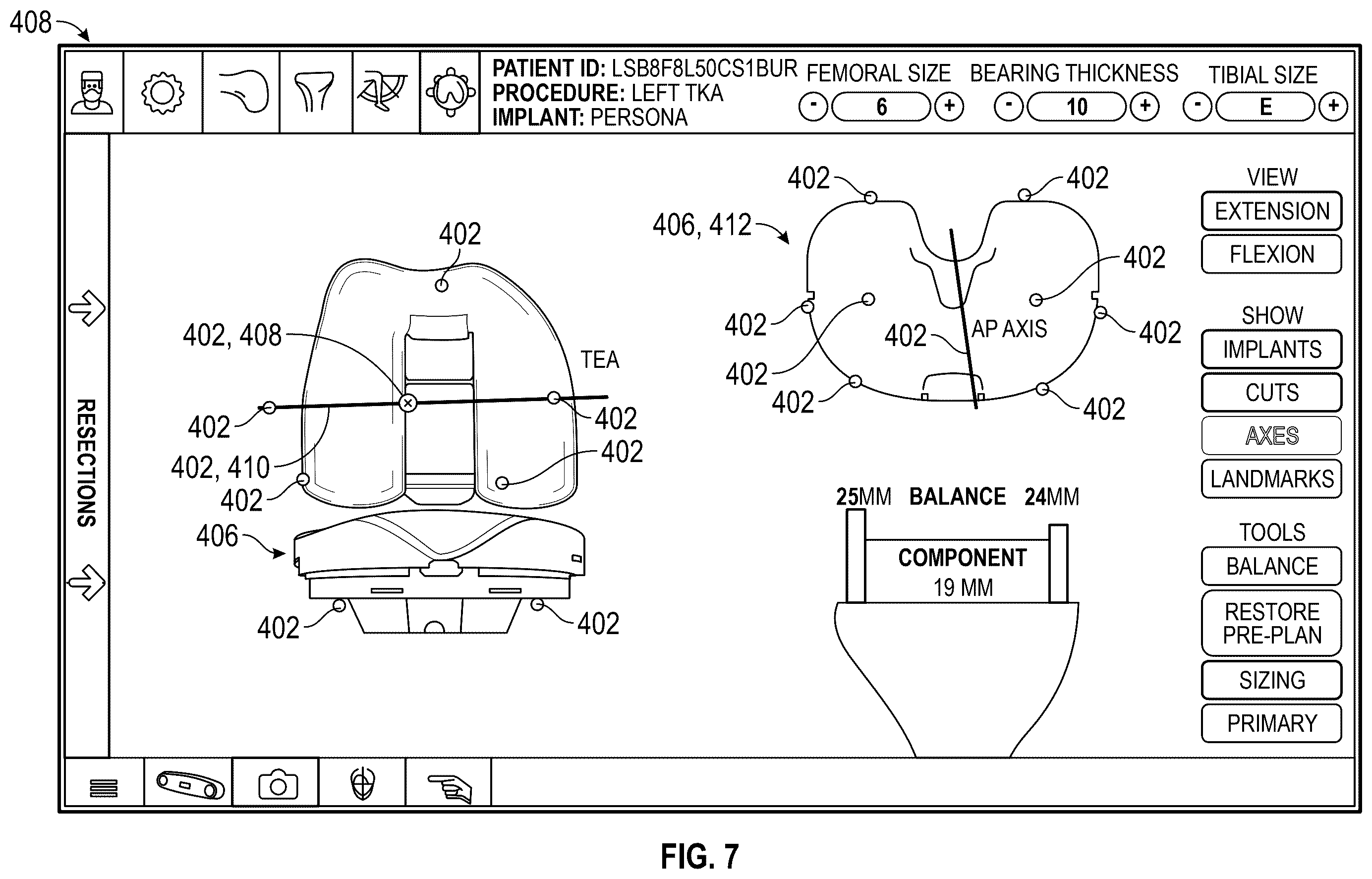 Patent US12569306 Figure 8 – Robotic revision knee arthroplasty virtual reconstruction system
