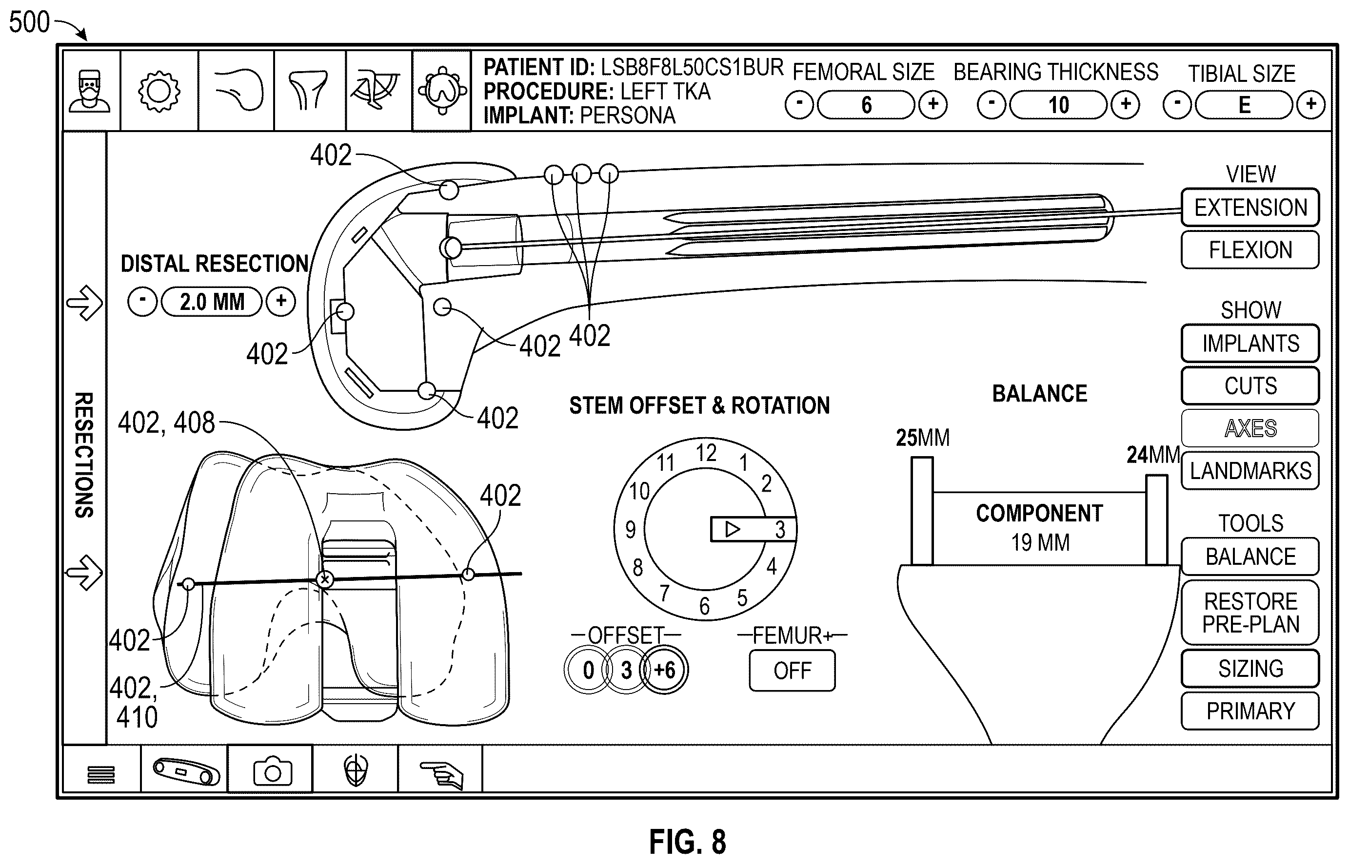 Patent US12569306 Figure 9 – Robotic revision knee arthroplasty virtual reconstruction system