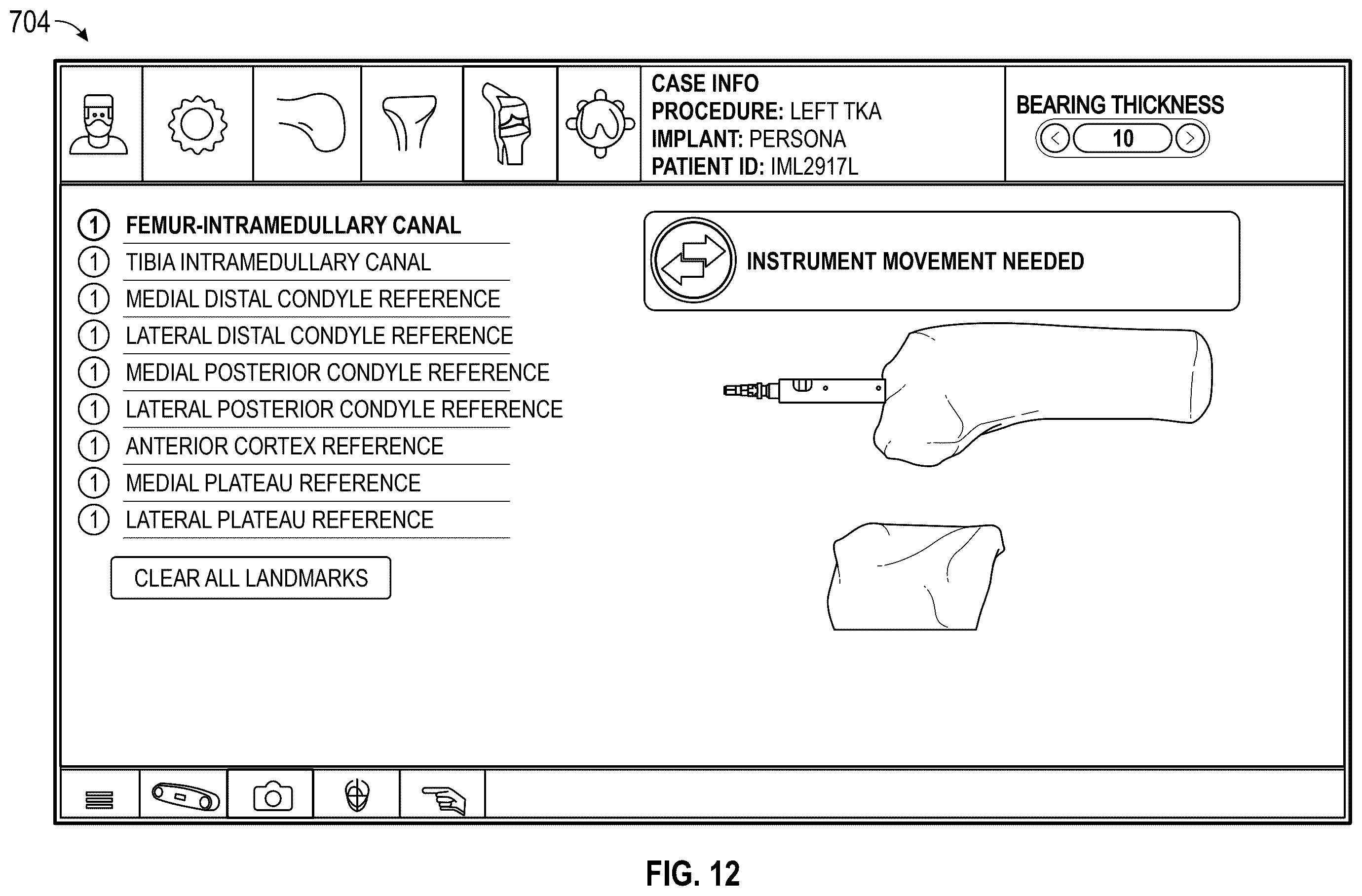 Patent US12569306 Figure 13 – Robotic revision knee arthroplasty virtual reconstruction system