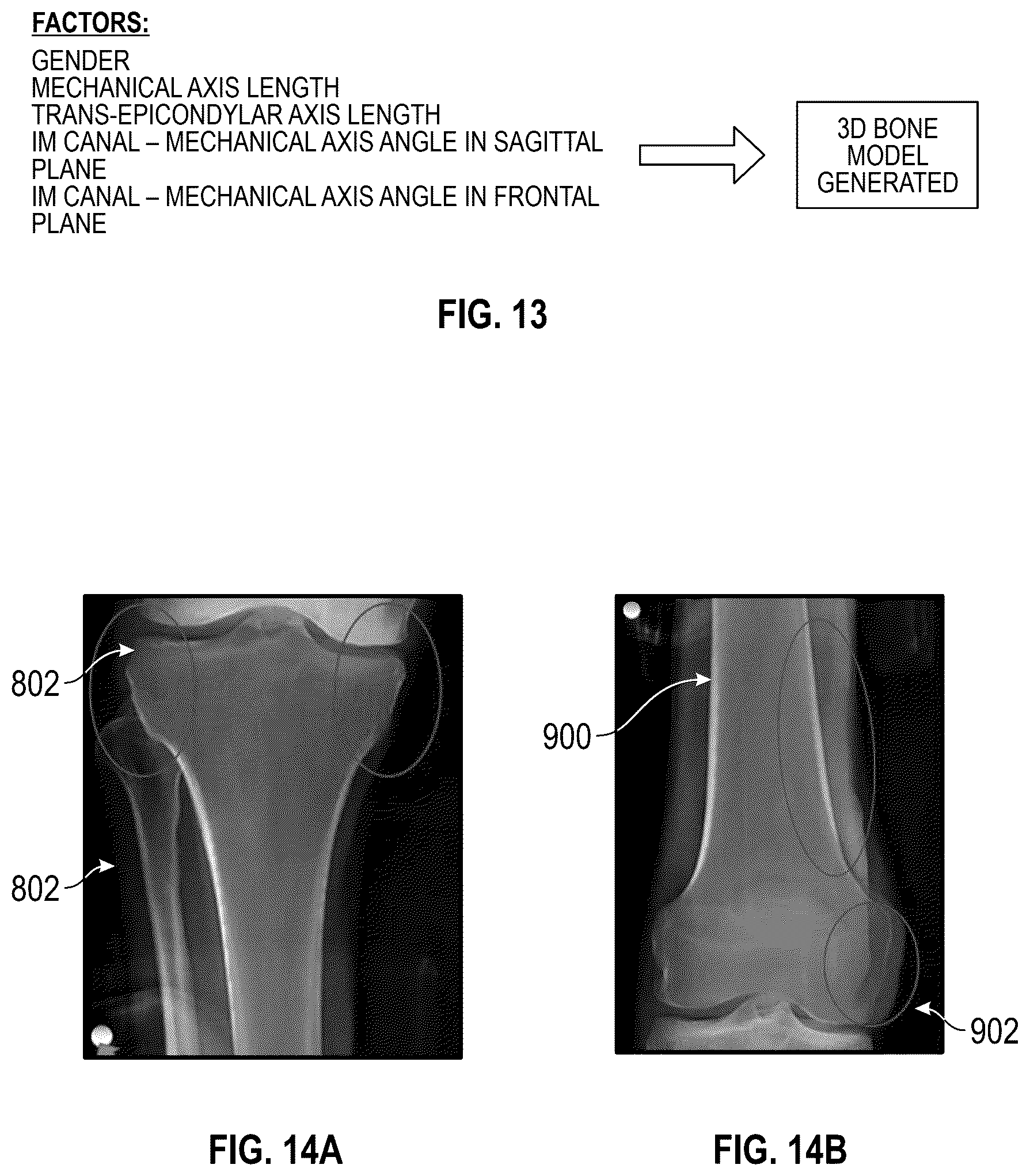 Patent US12569306 Figure 14 – Robotic revision knee arthroplasty virtual reconstruction system