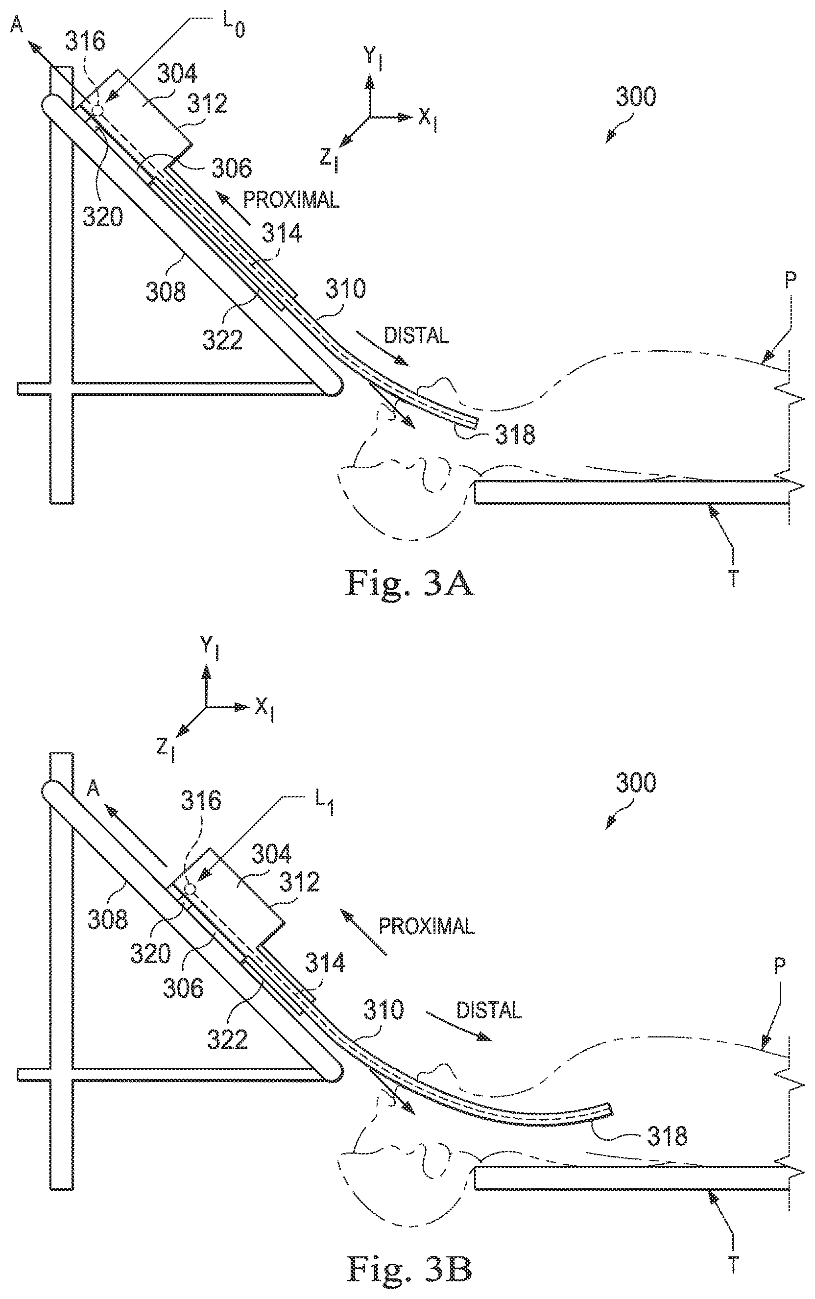 Patent US12569309 Figure 4 – Systems and methods for monitoring patient motion during a medical procedure