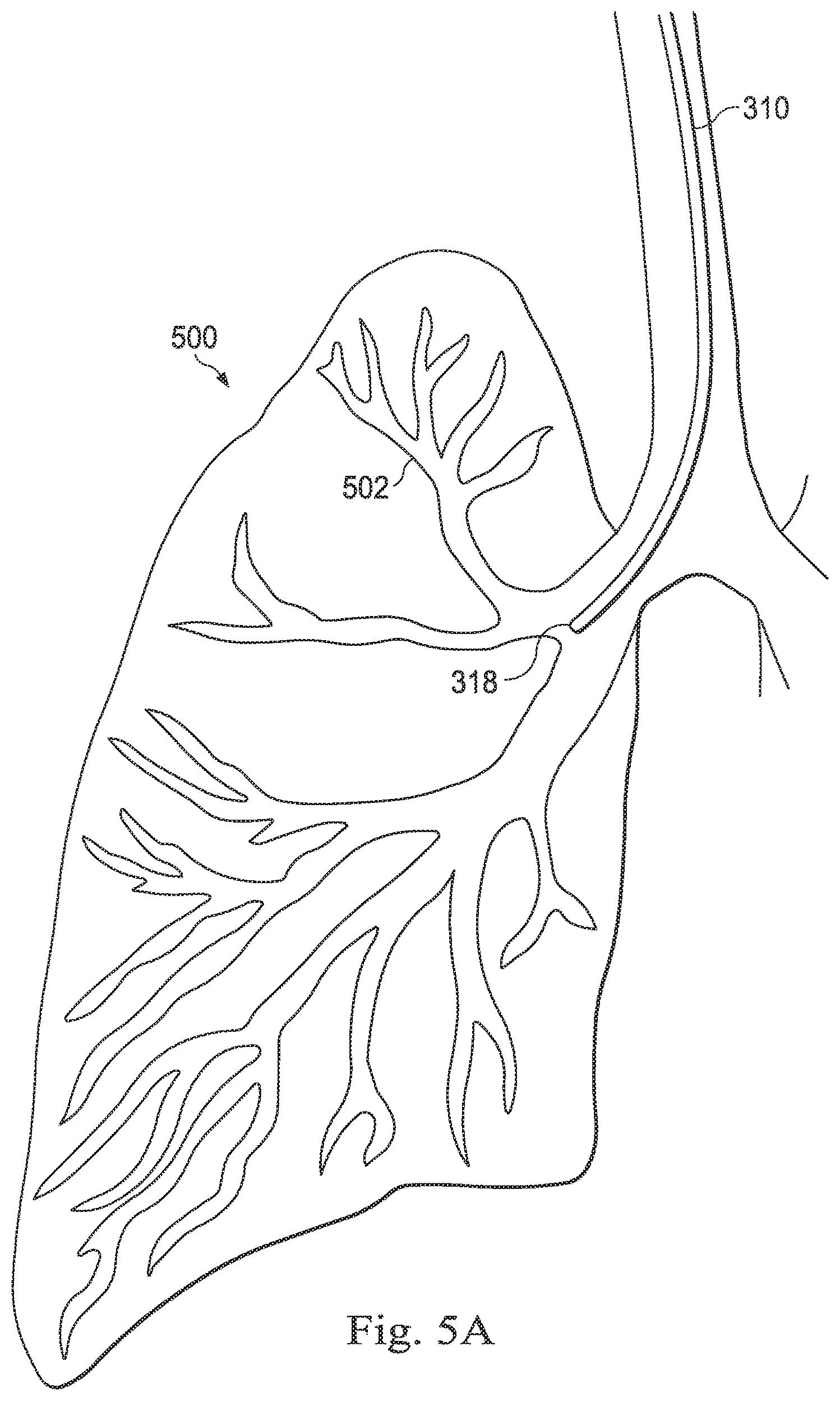 Patent US12569309 Figure 6 – Systems and methods for monitoring patient motion during a medical procedure