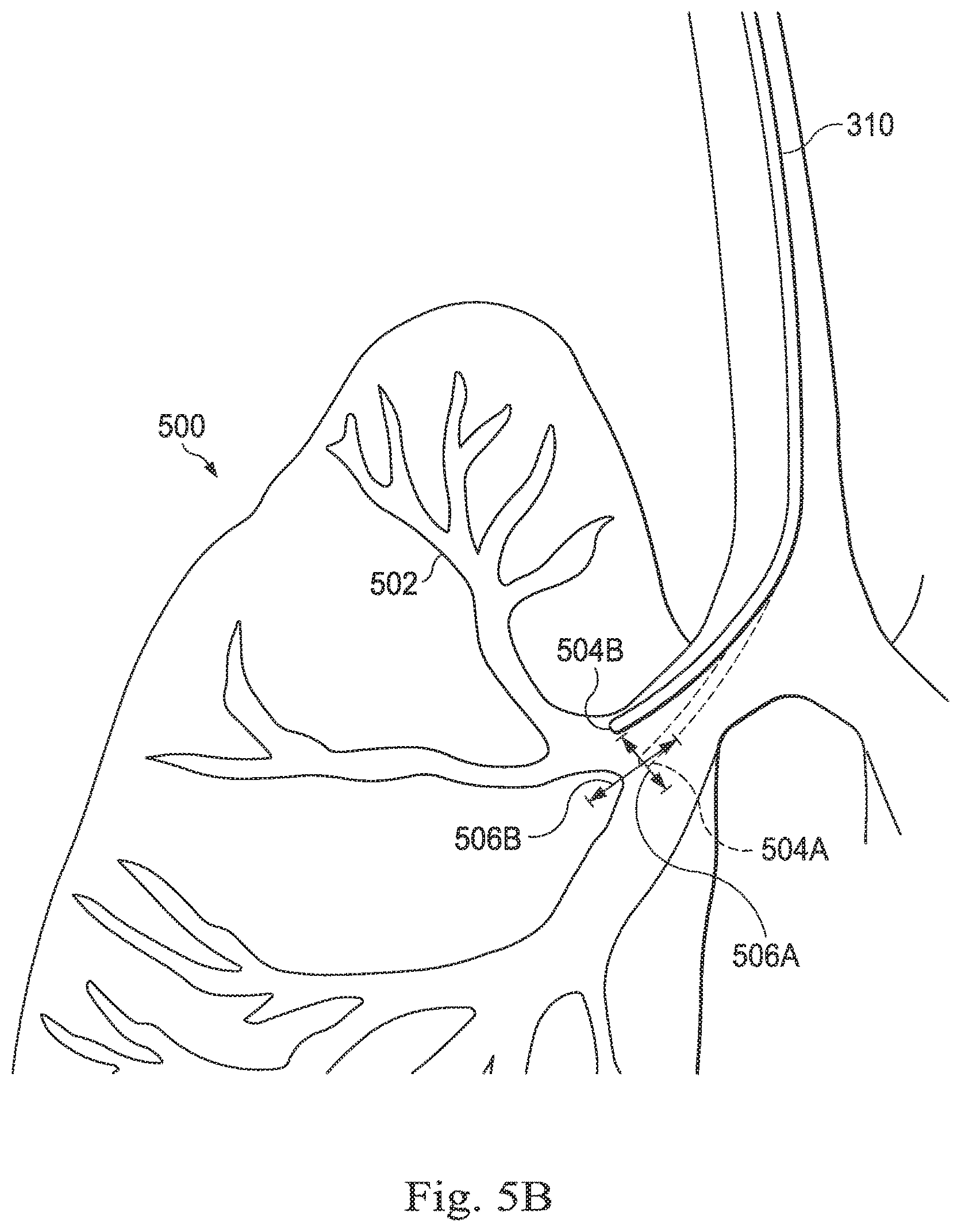 Patent US12569309 Figure 7 – Systems and methods for monitoring patient motion during a medical procedure