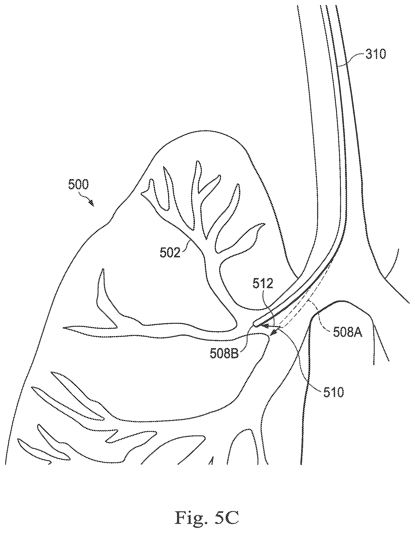 Patent US12569309 Figure 8 – Systems and methods for monitoring patient motion during a medical procedure