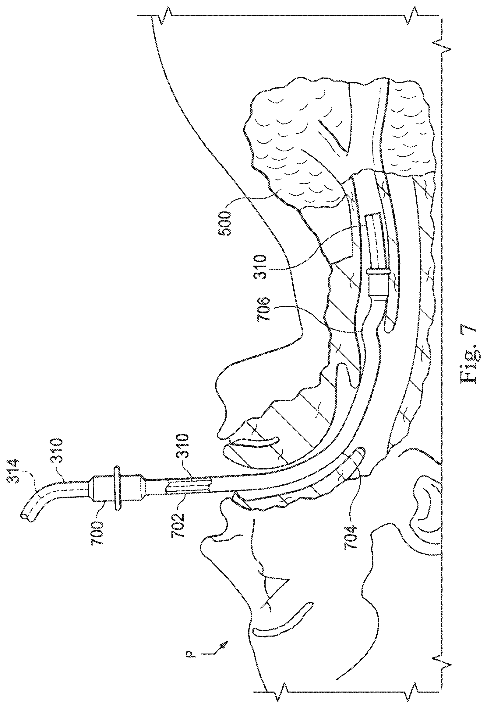 Patent US12569309 Figure 10 – Systems and methods for monitoring patient motion during a medical procedure