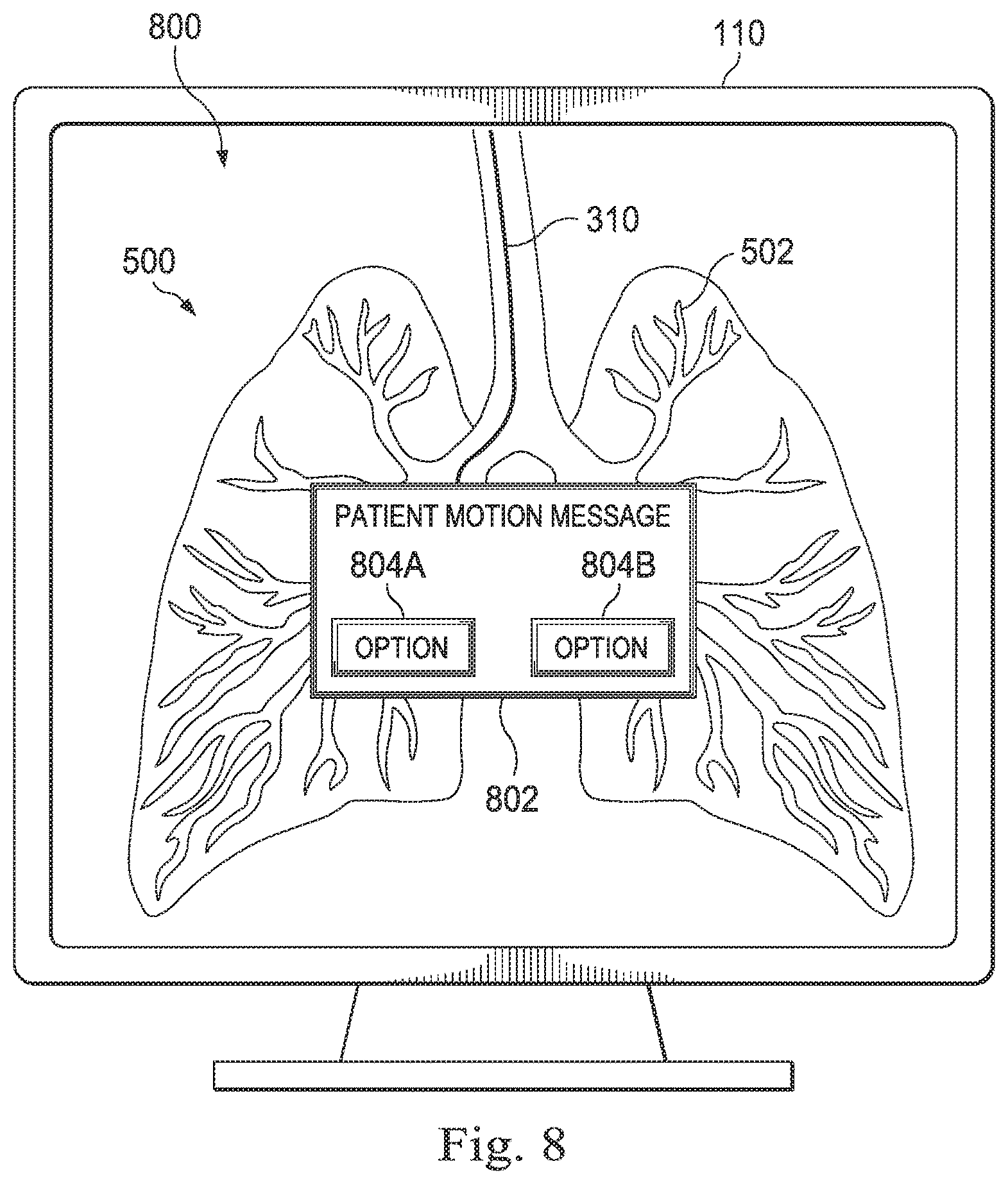 Patent US12569309 Figure 11 – Systems and methods for monitoring patient motion during a medical procedure
