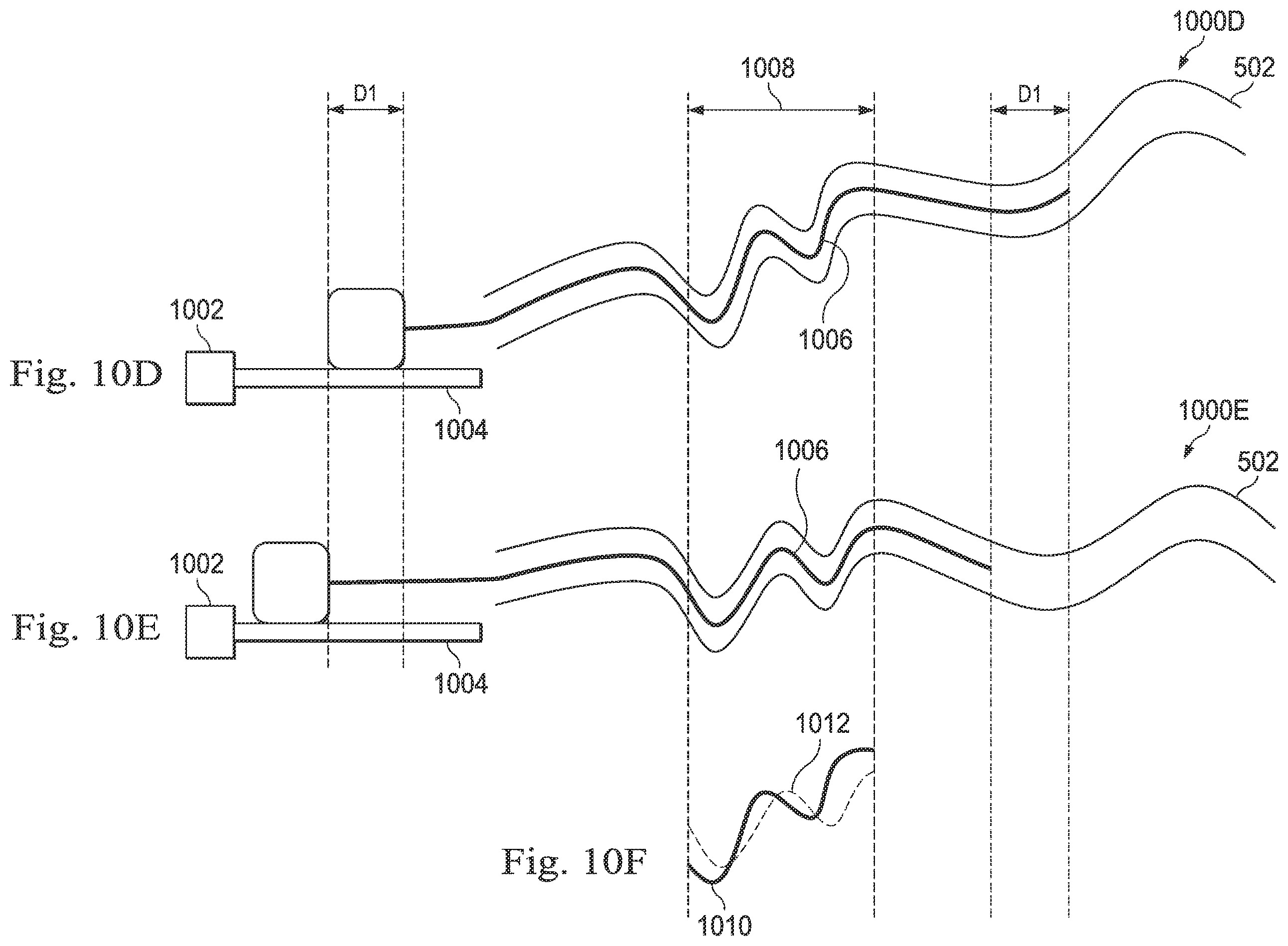 Patent US12569309 Figure 14 – Systems and methods for monitoring patient motion during a medical procedure