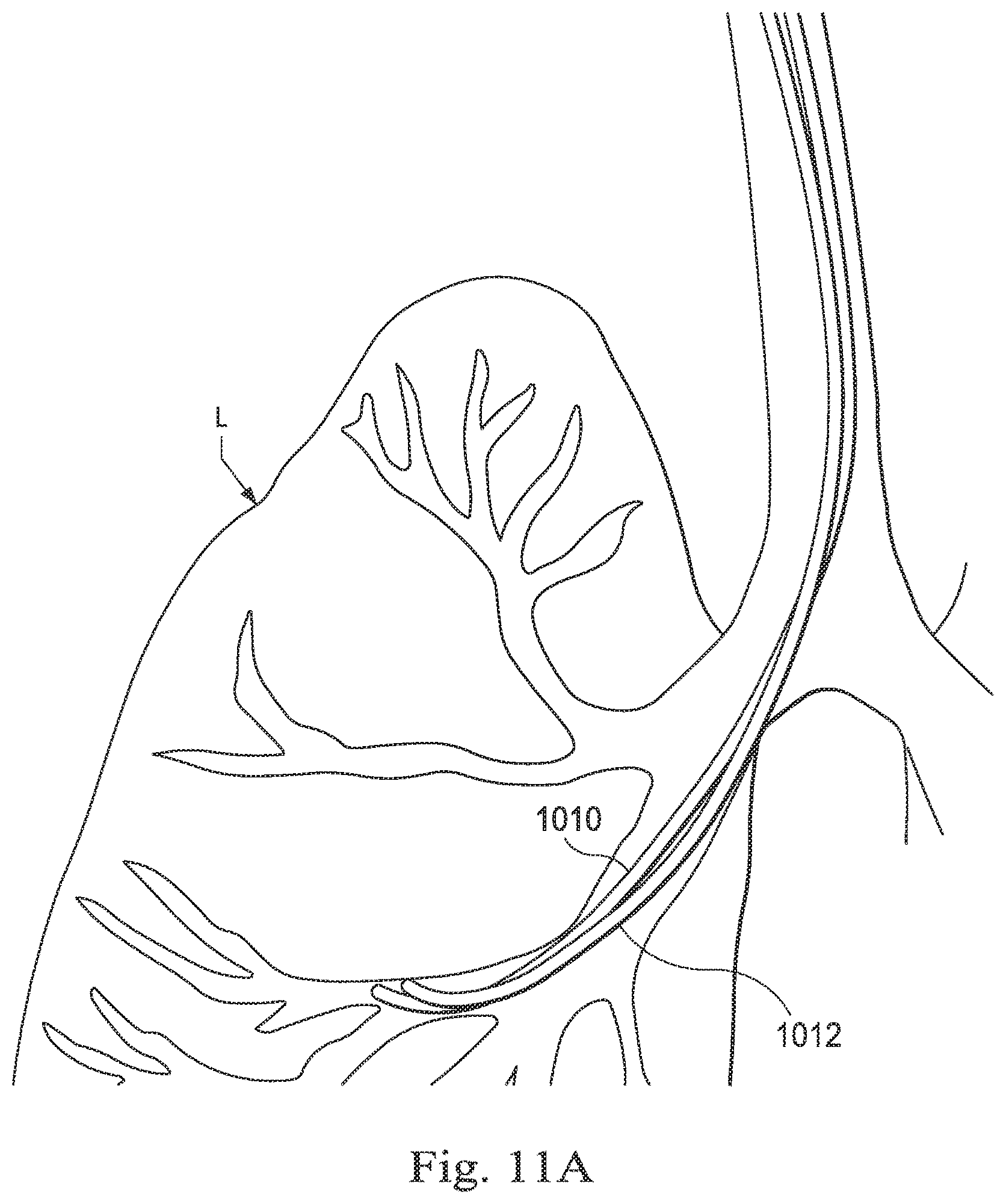 Patent US12569309 Figure 15 – Systems and methods for monitoring patient motion during a medical procedure