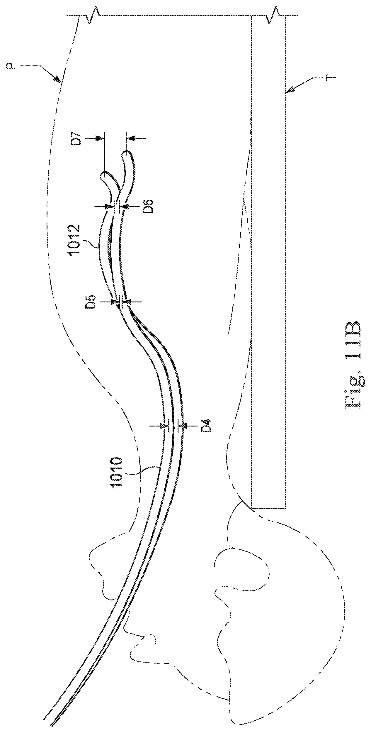 Patent US12569309 Figure 16 – Systems and methods for monitoring patient motion during a medical procedure