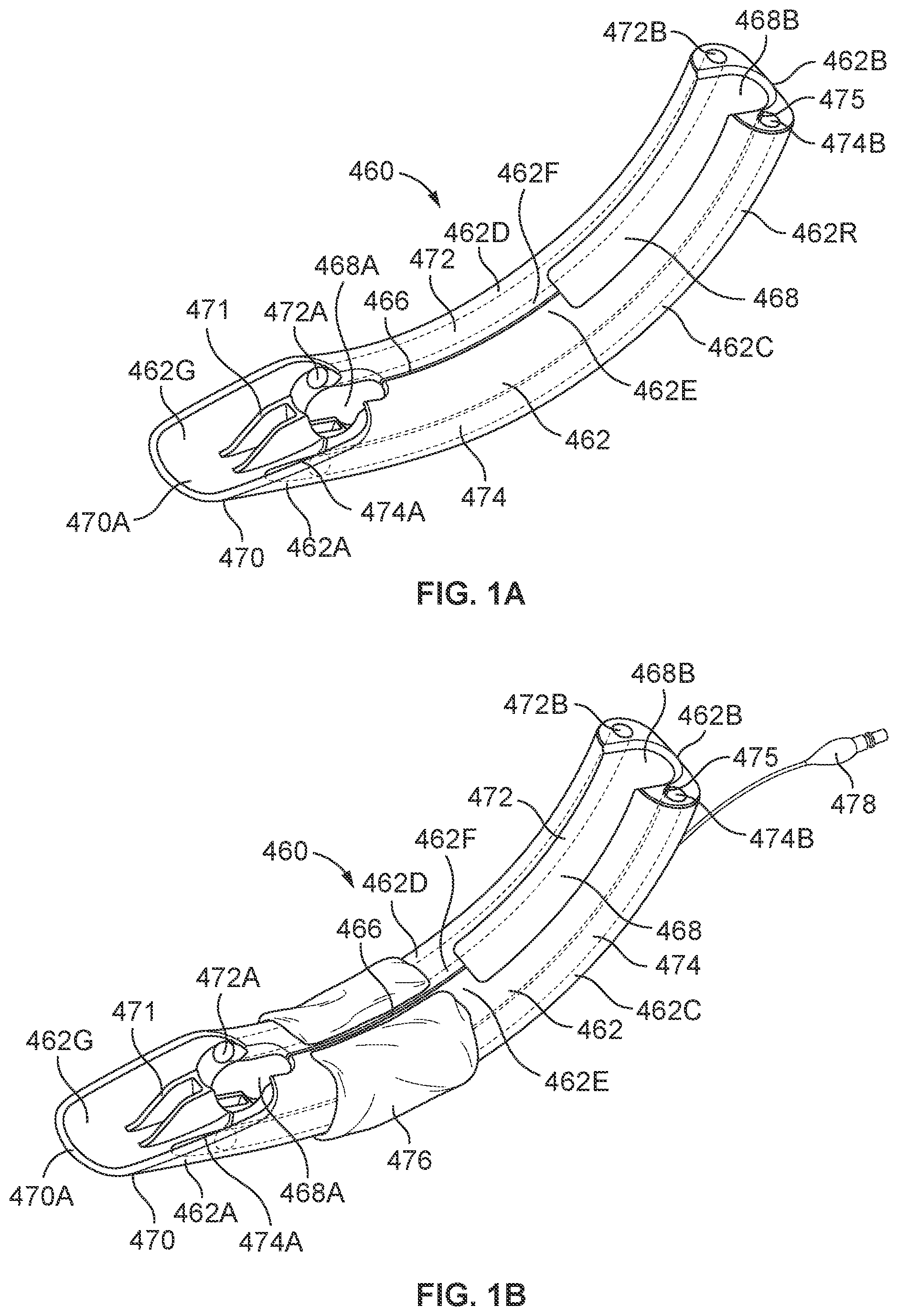 Patent US12569314 Figure 1 – Medical devices for airway management and methods of placement