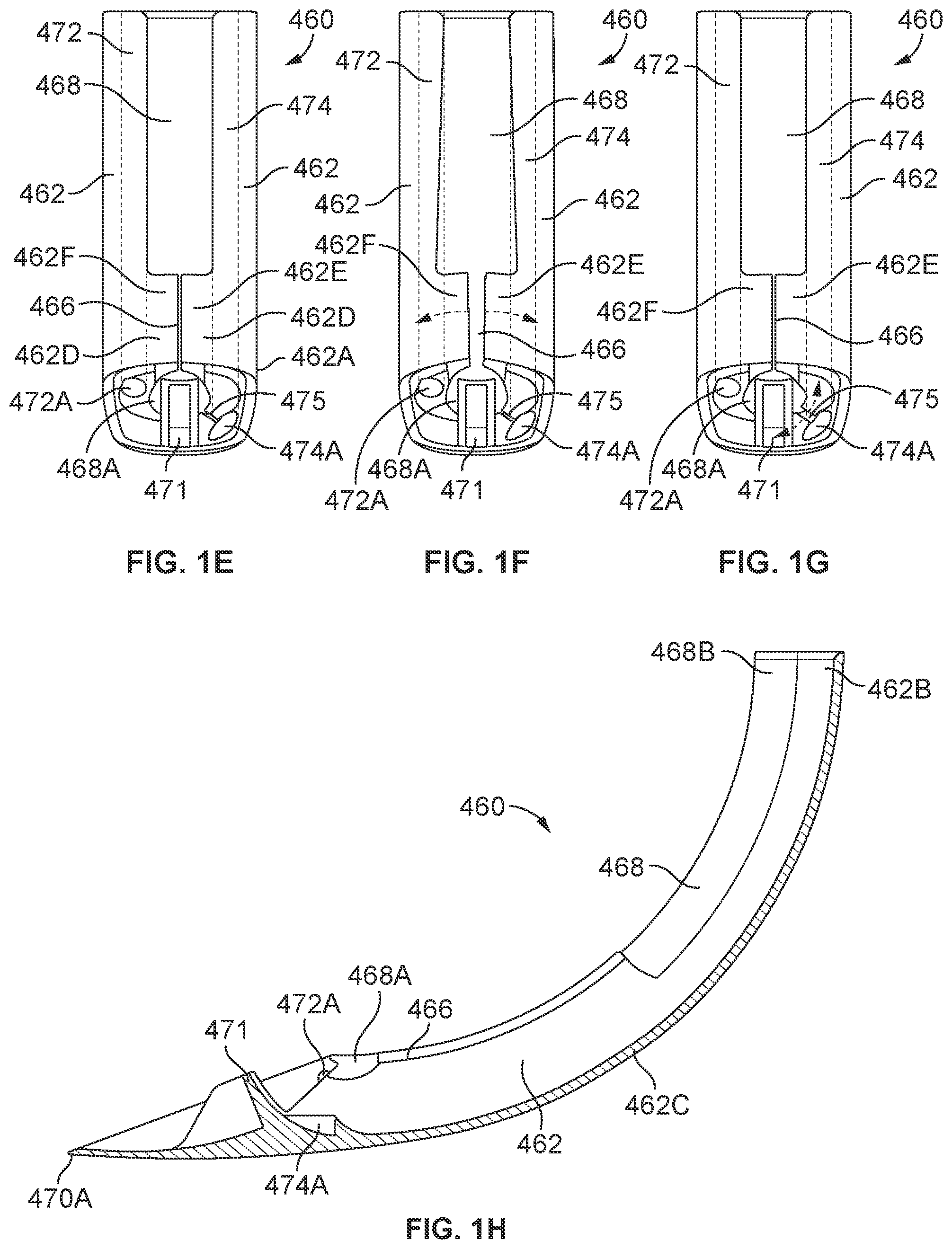 Patent US12569314 Figure 3 – Medical devices for airway management and methods of placement