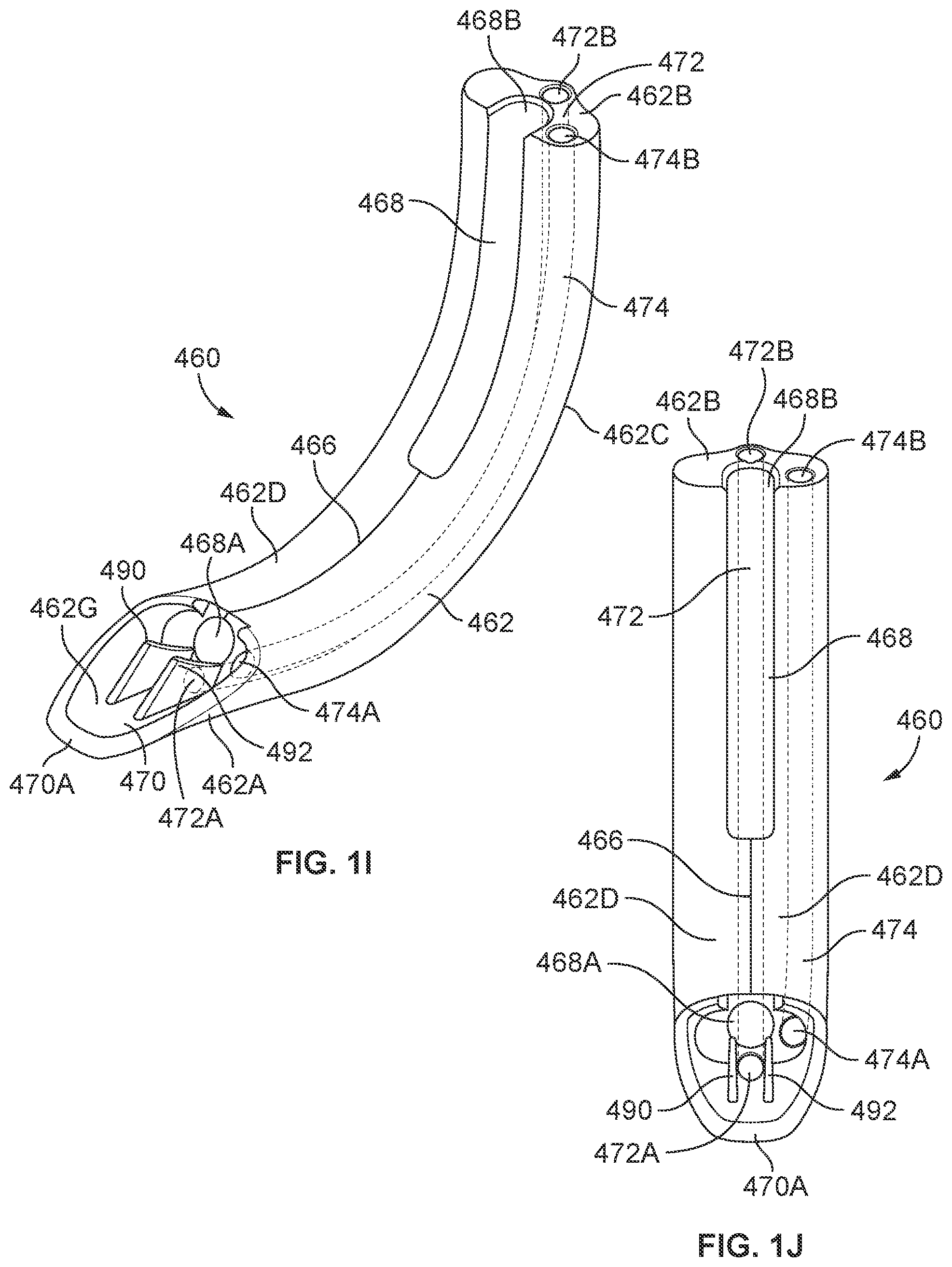Patent US12569314 Figure 4 – Medical devices for airway management and methods of placement