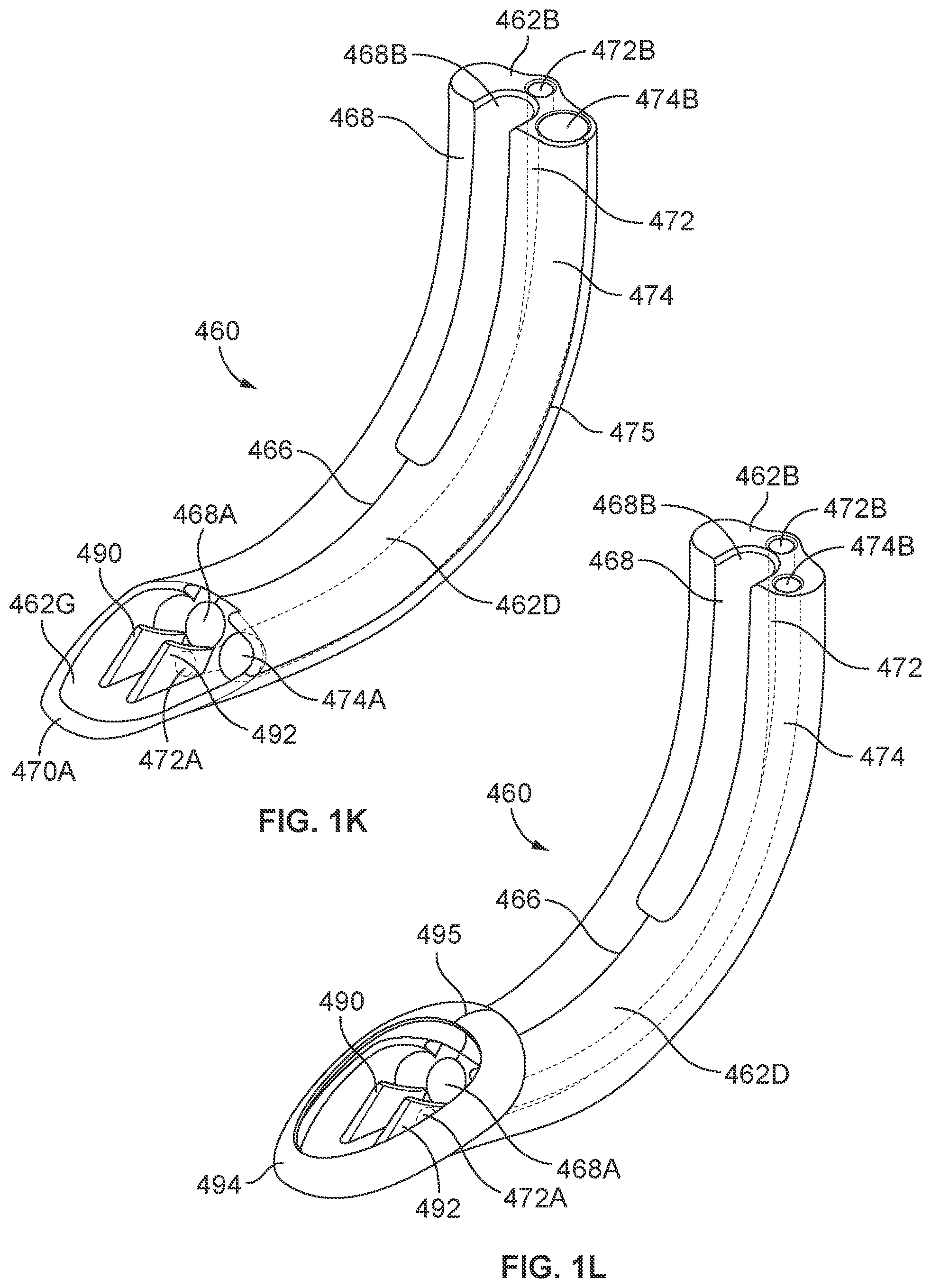 Patent US12569314 Figure 5 – Medical devices for airway management and methods of placement