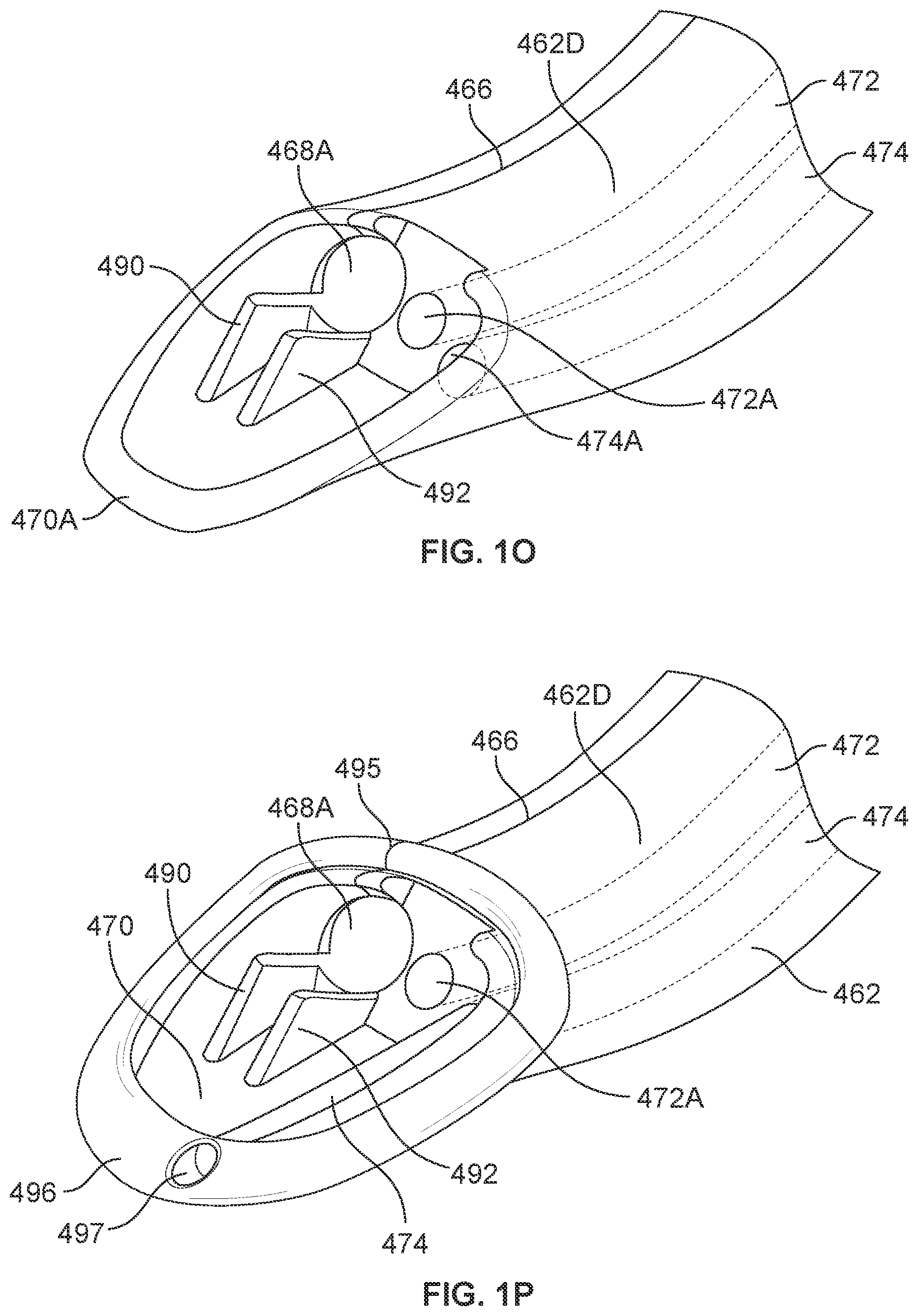 Patent US12569314 Figure 7 – Medical devices for airway management and methods of placement
